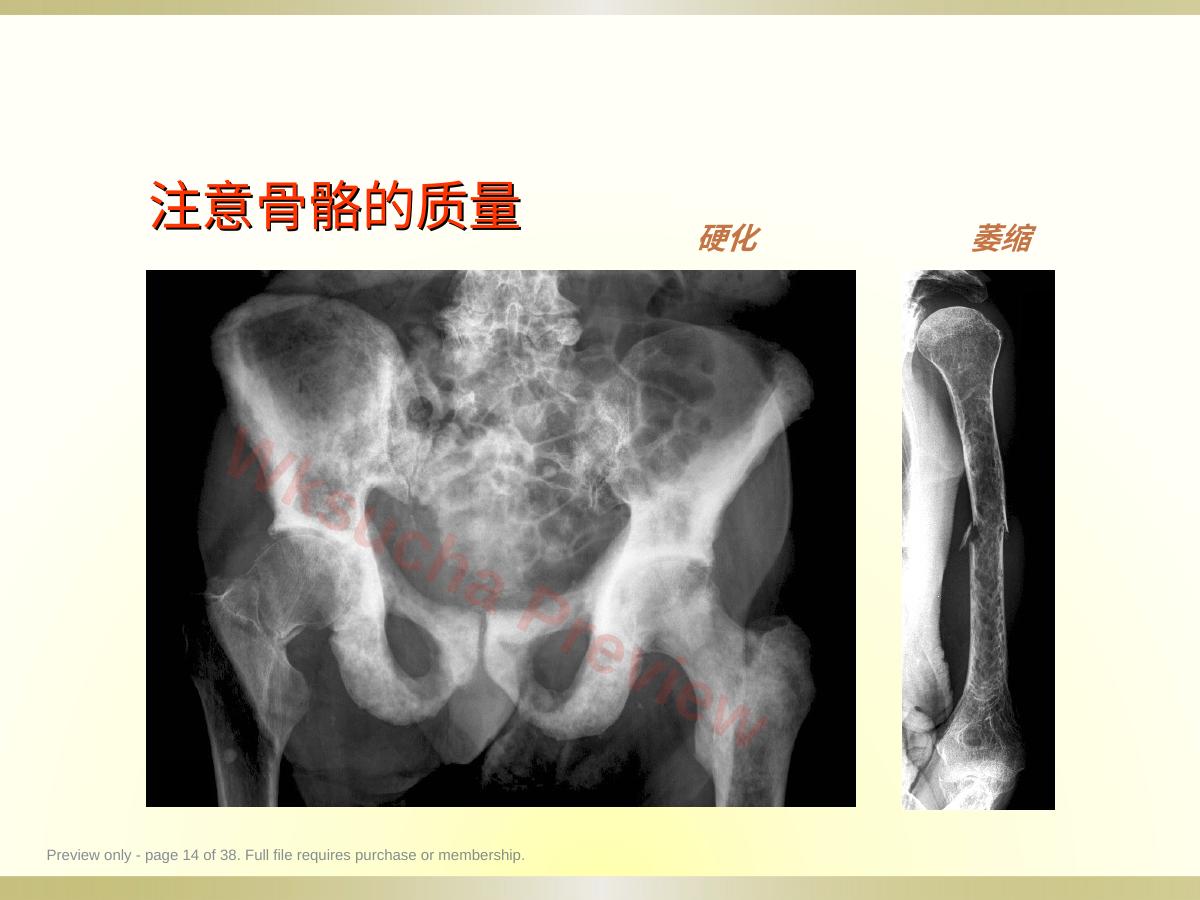 预览第 14 页