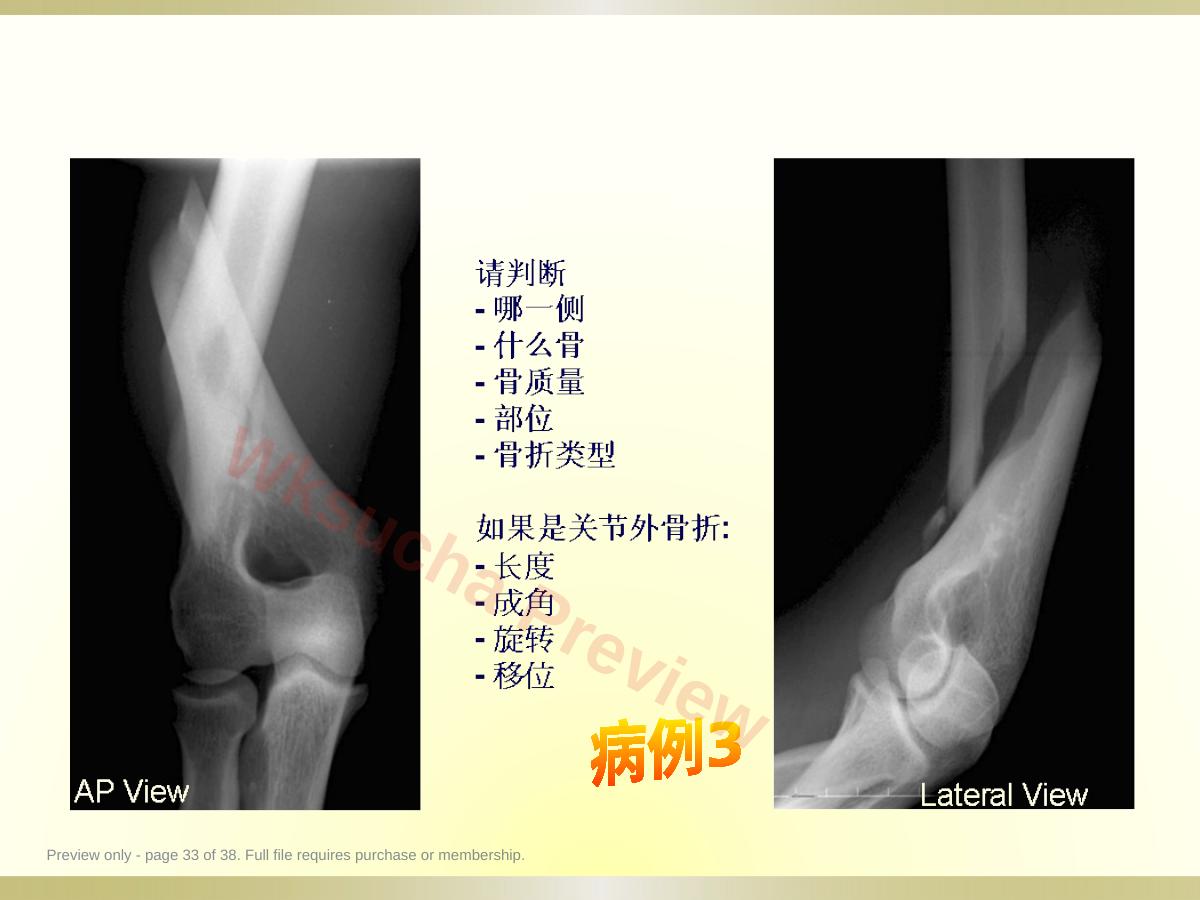 预览第 33 页