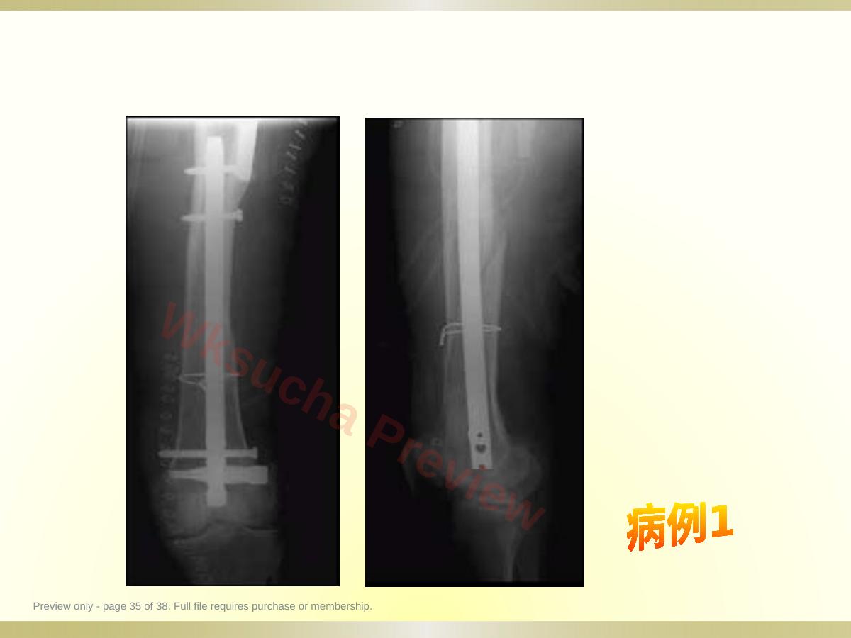 预览第 35 页