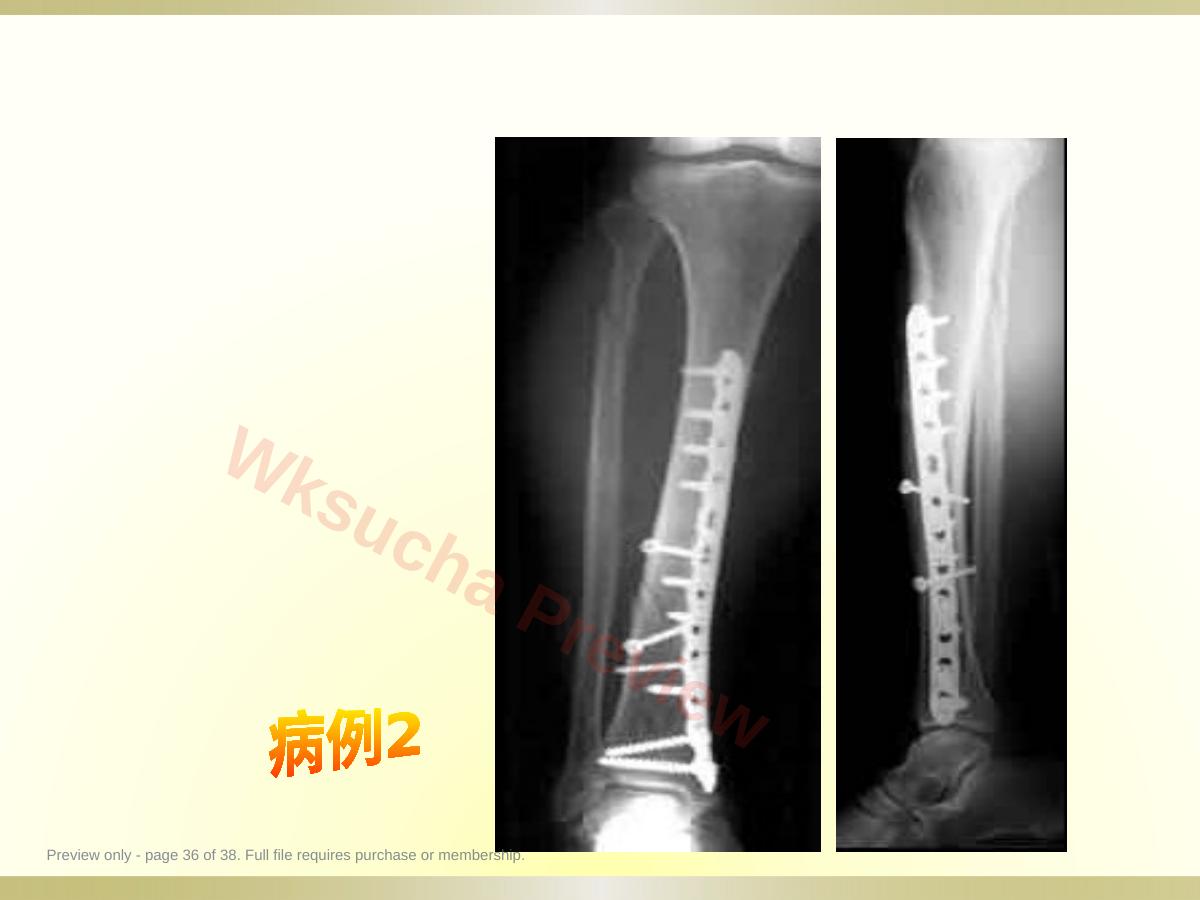 预览第 36 页