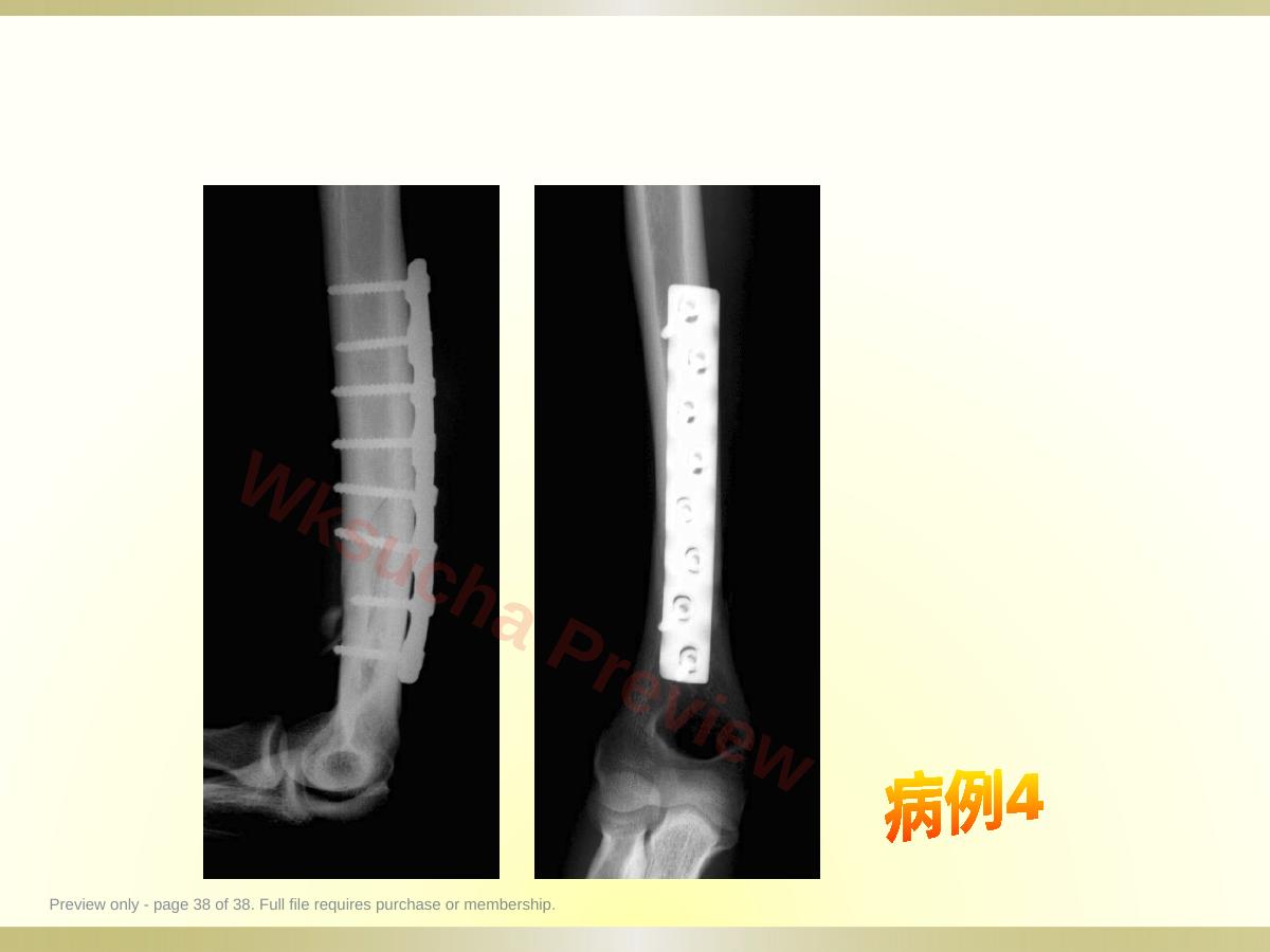 预览第 38 页