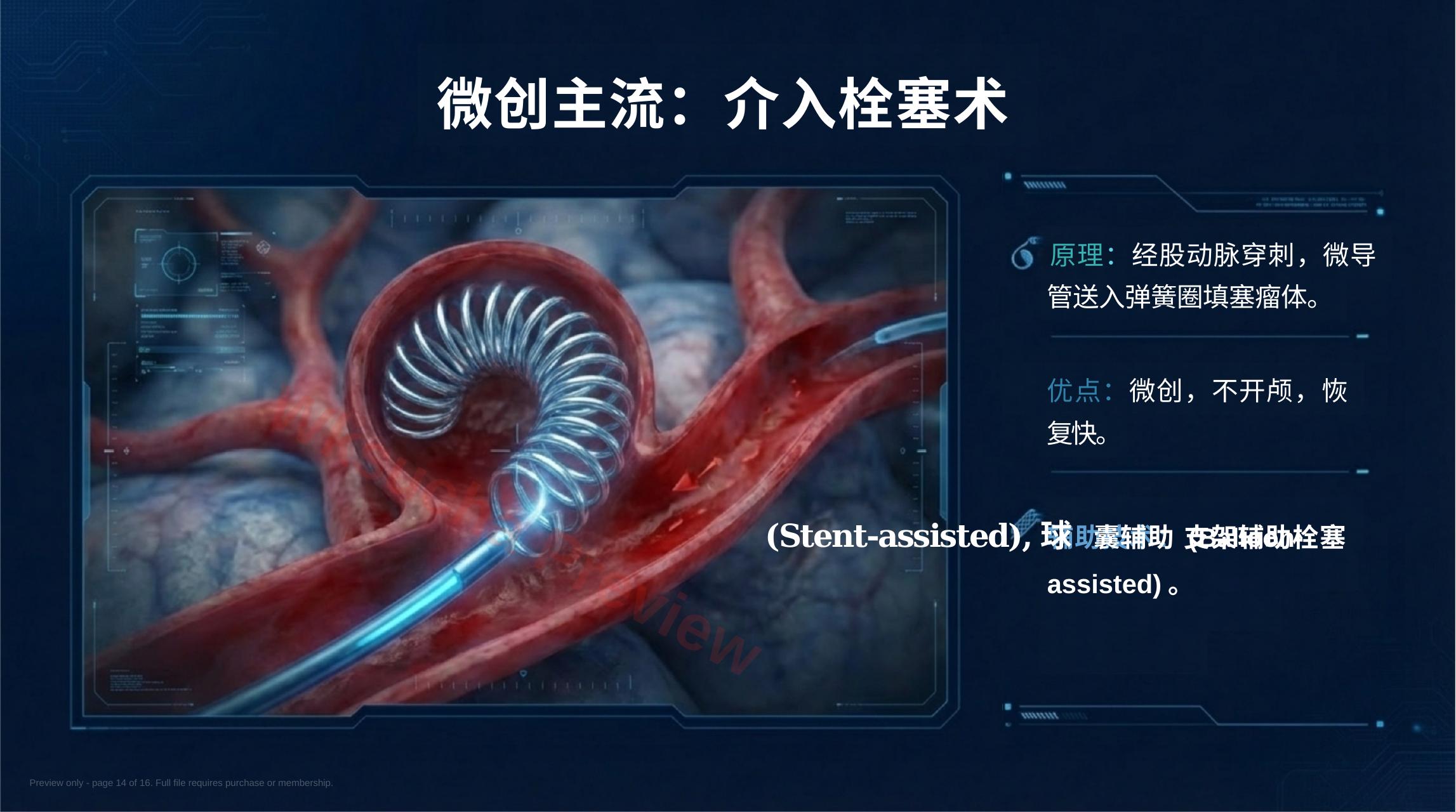 预览第 14 页