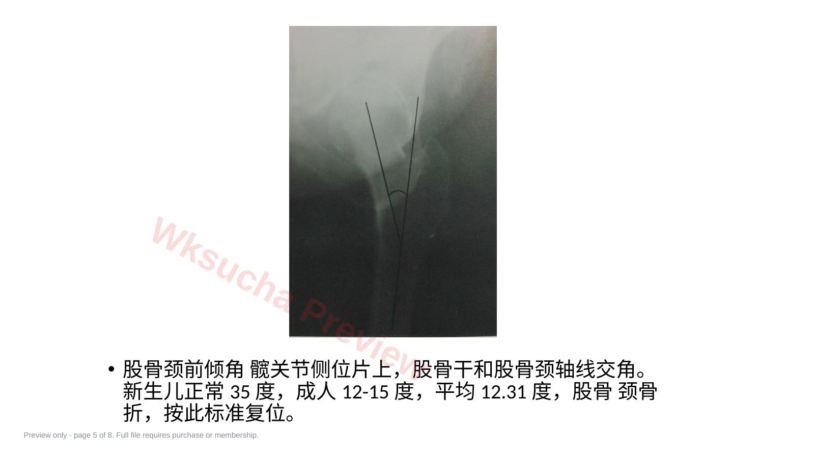 预览第 5 页