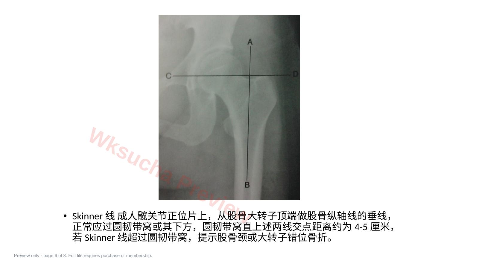 预览第 6 页