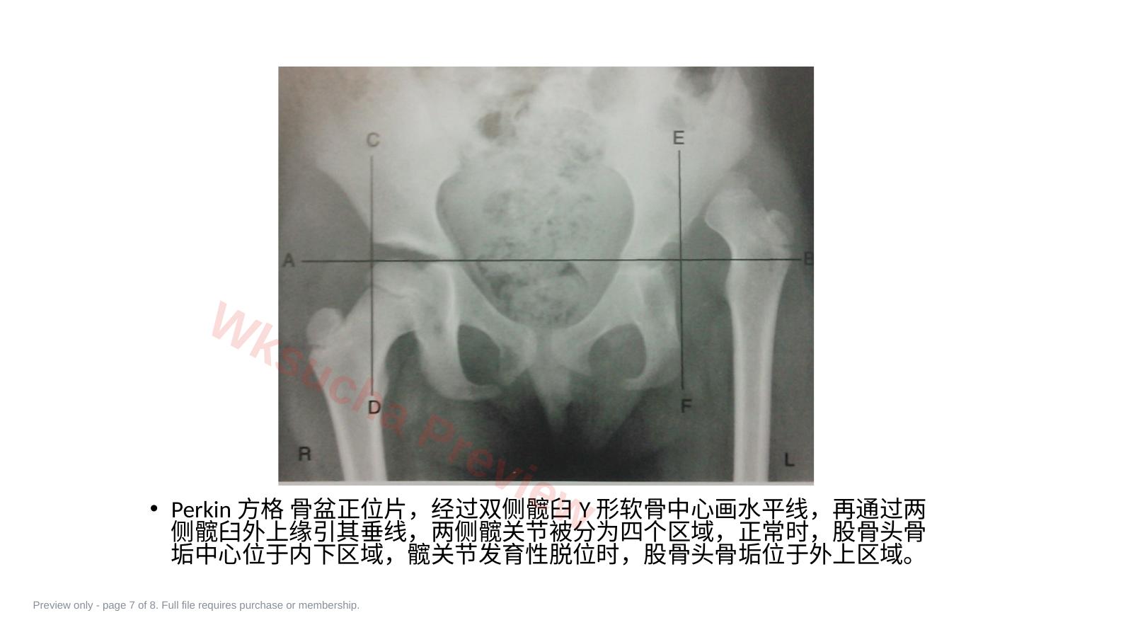 预览第 7 页