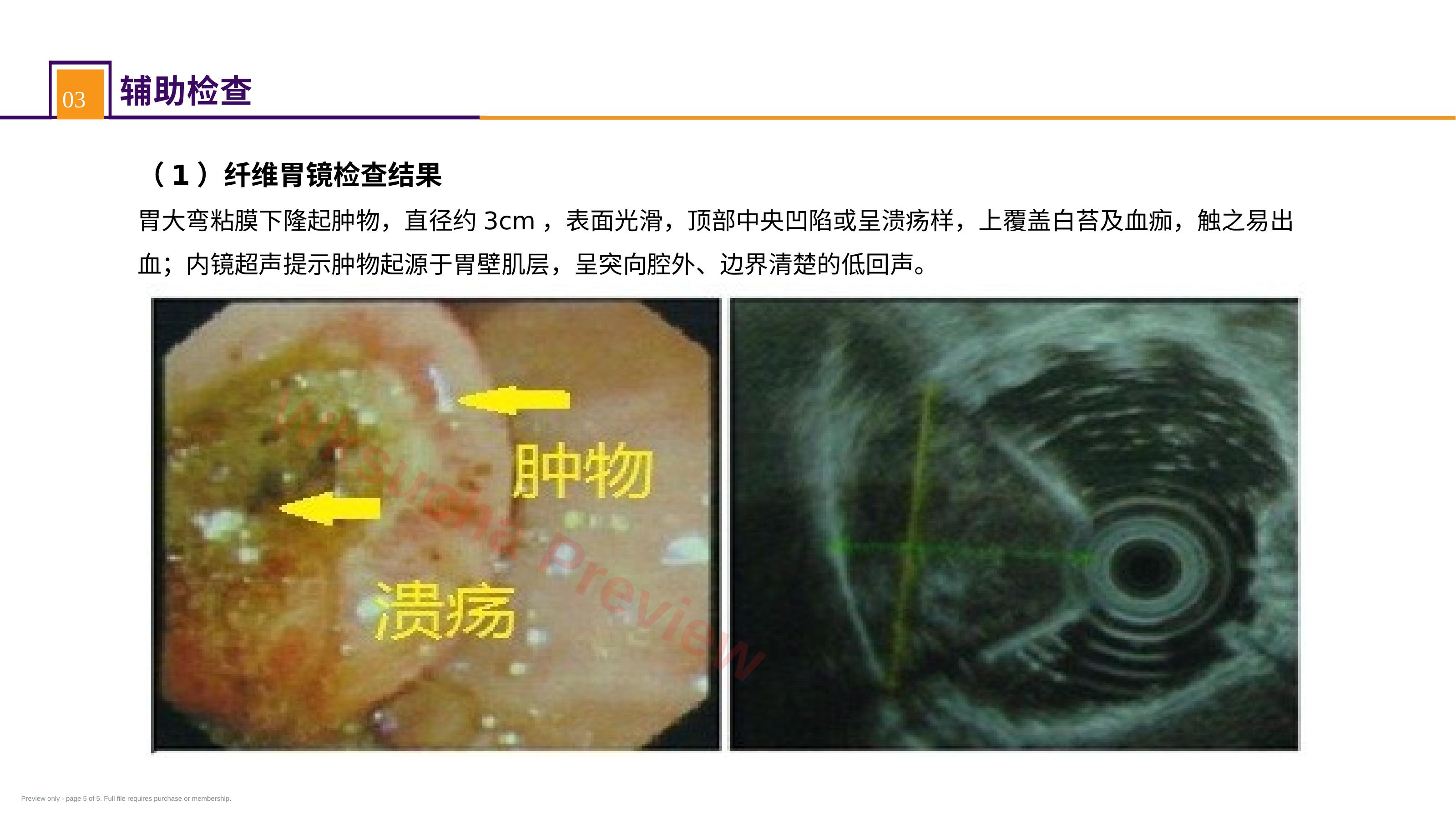 预览第 5 页