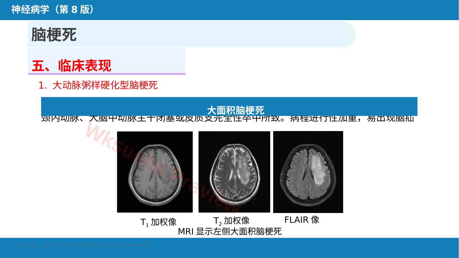 预览第 15 页