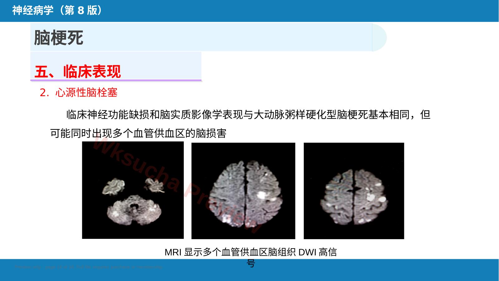 预览第 18 页