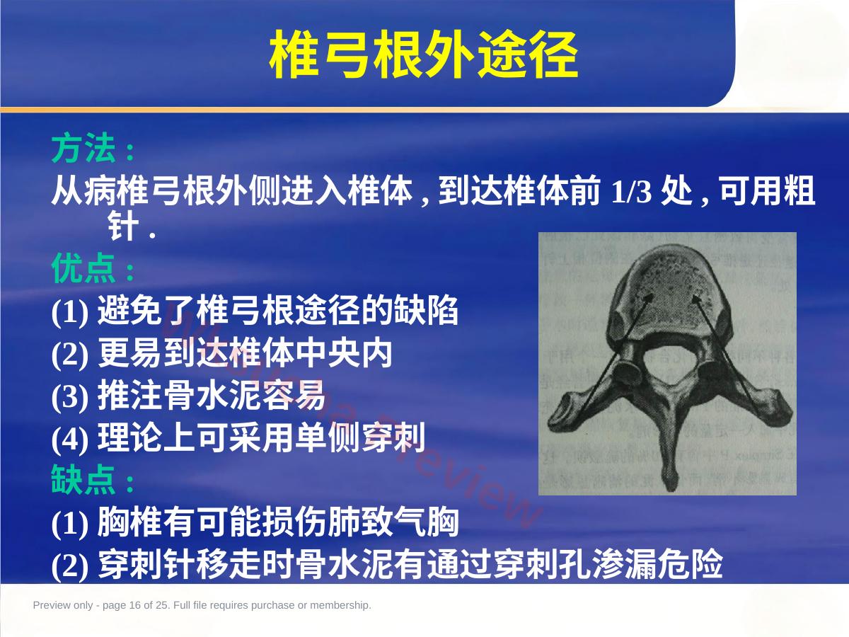预览第 16 页