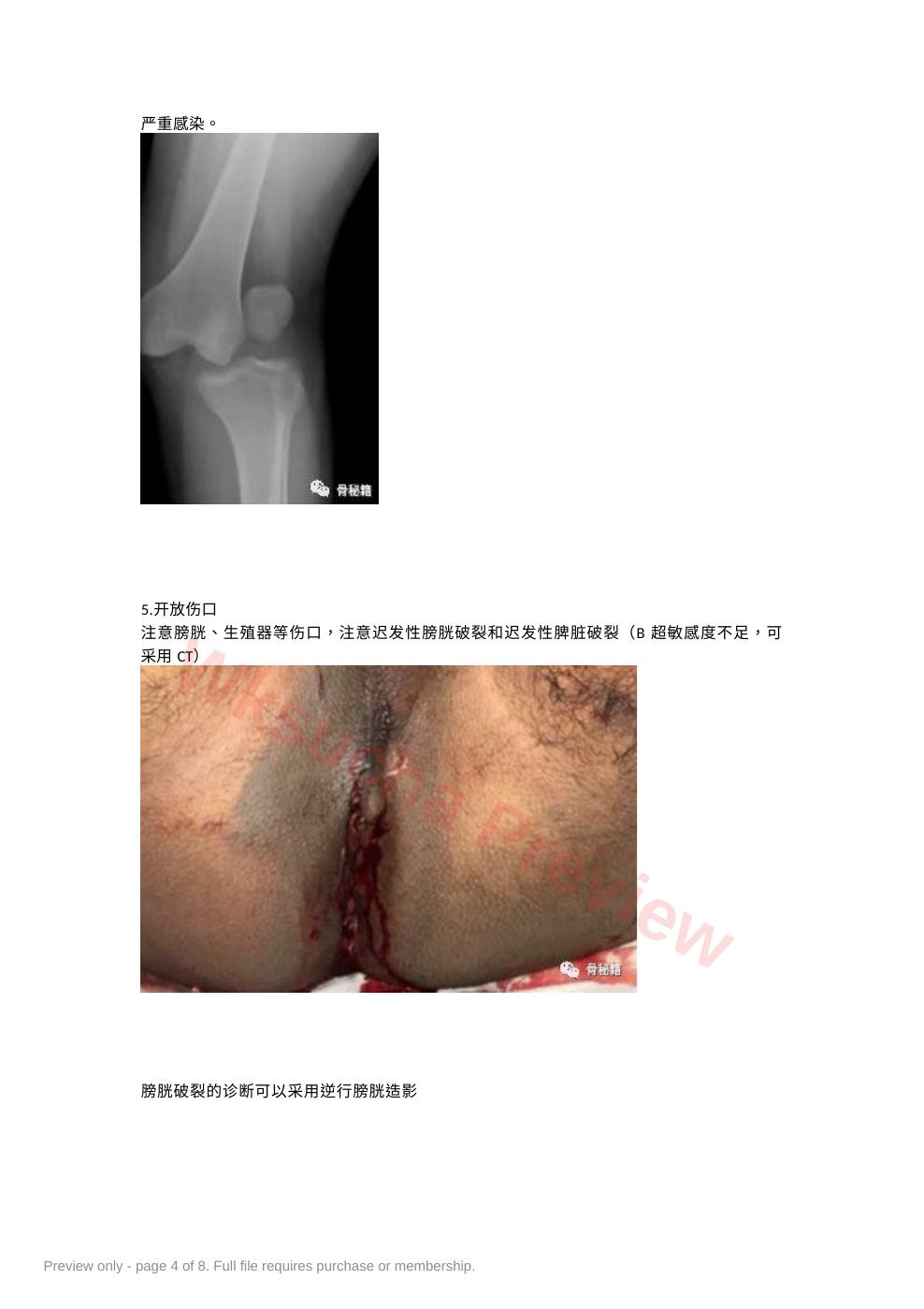 预览第 4 页
