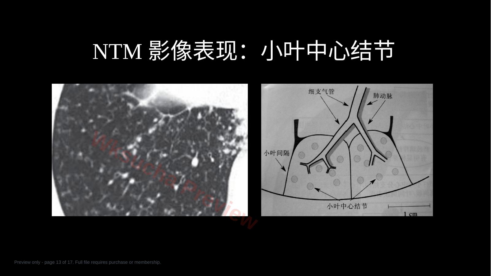 预览第 13 页