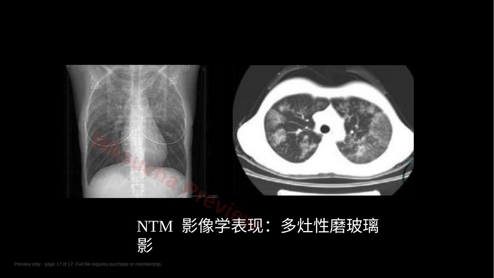 预览第 17 页