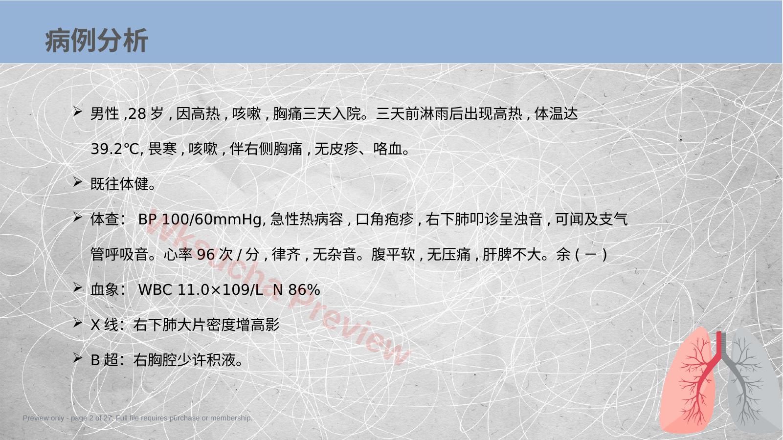 预览第 2 页