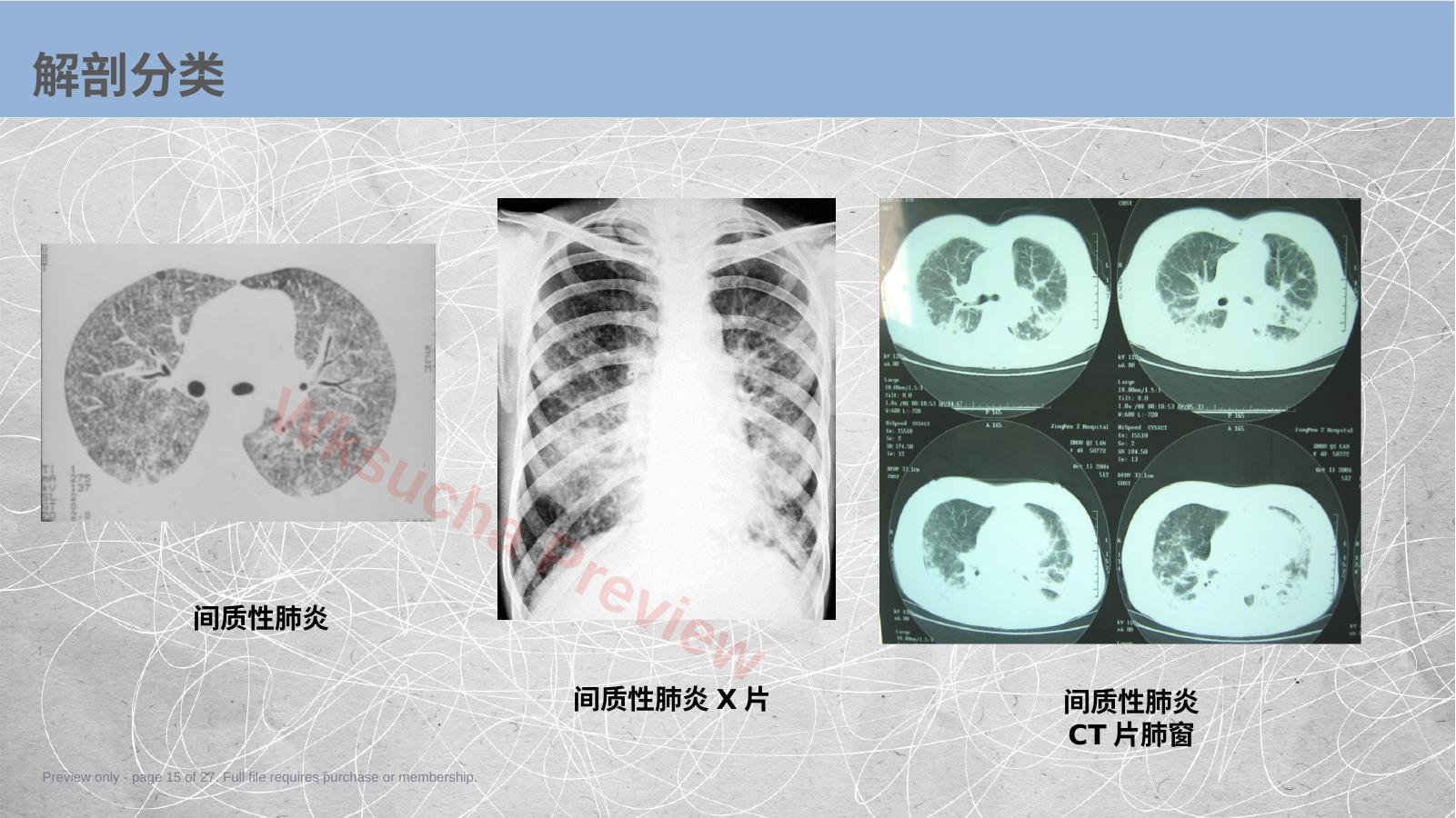 预览第 15 页
