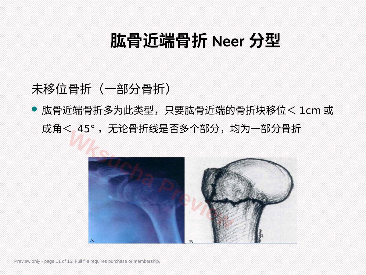 预览第 11 页