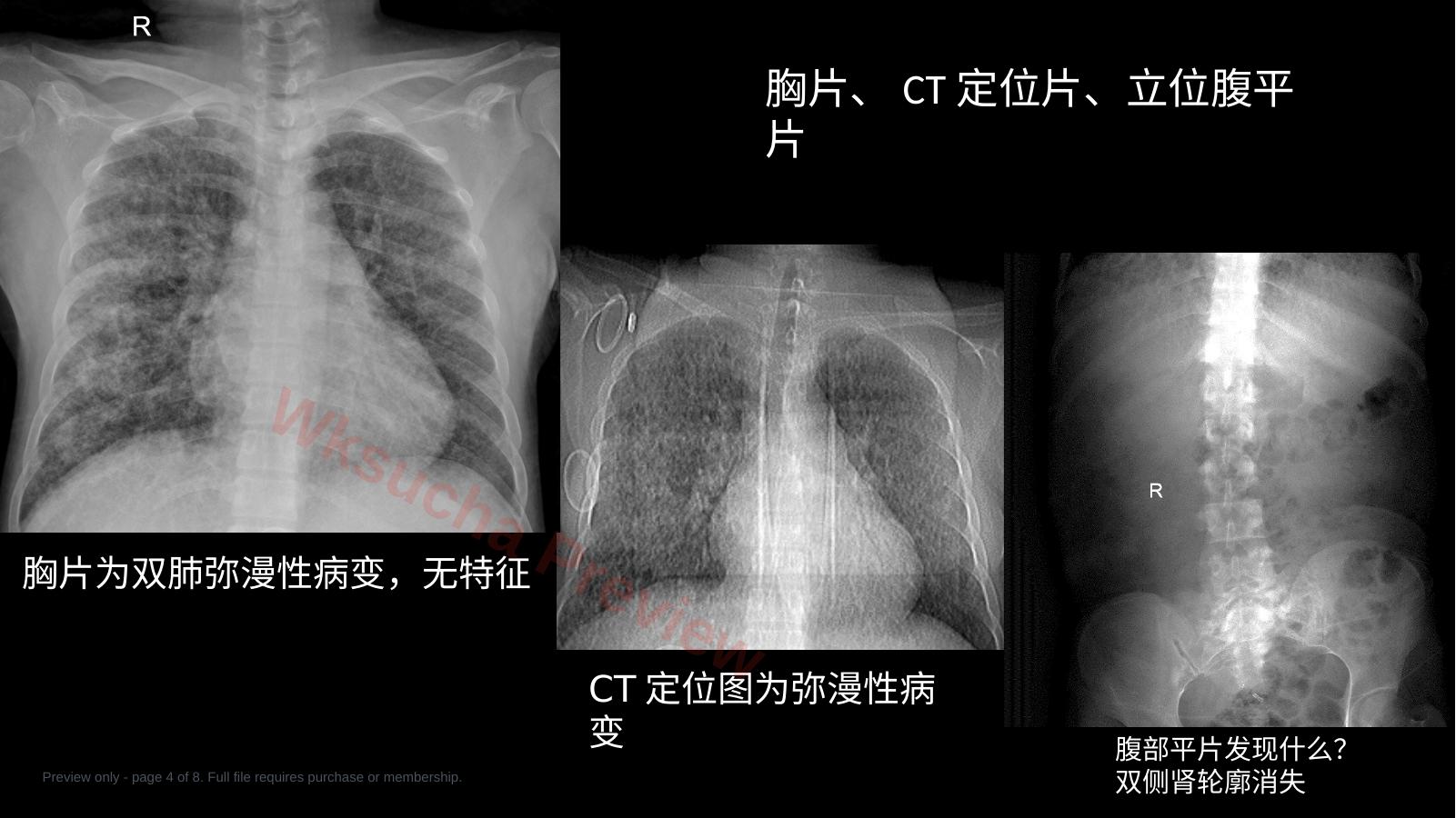 预览第 4 页