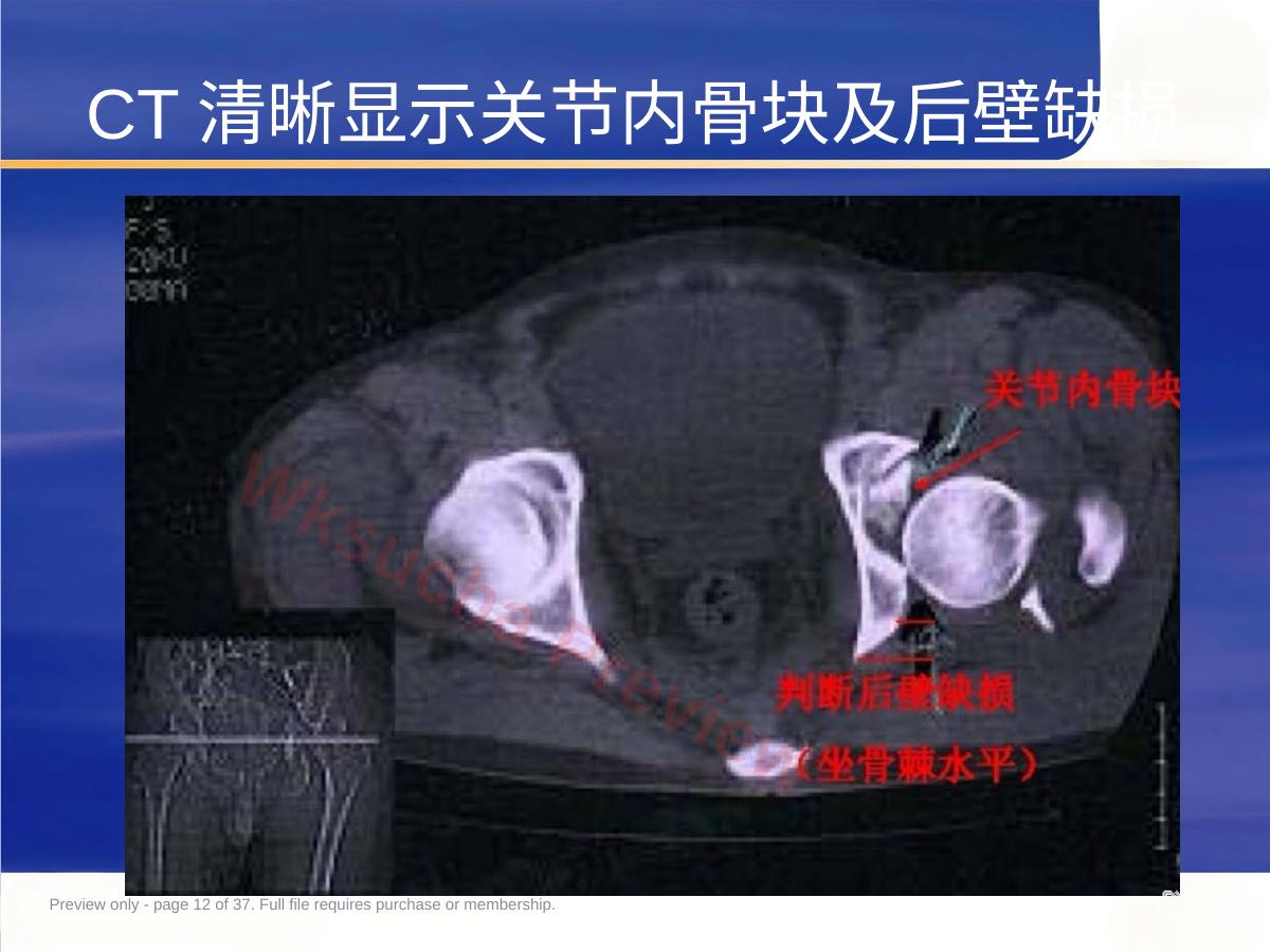 预览第 12 页