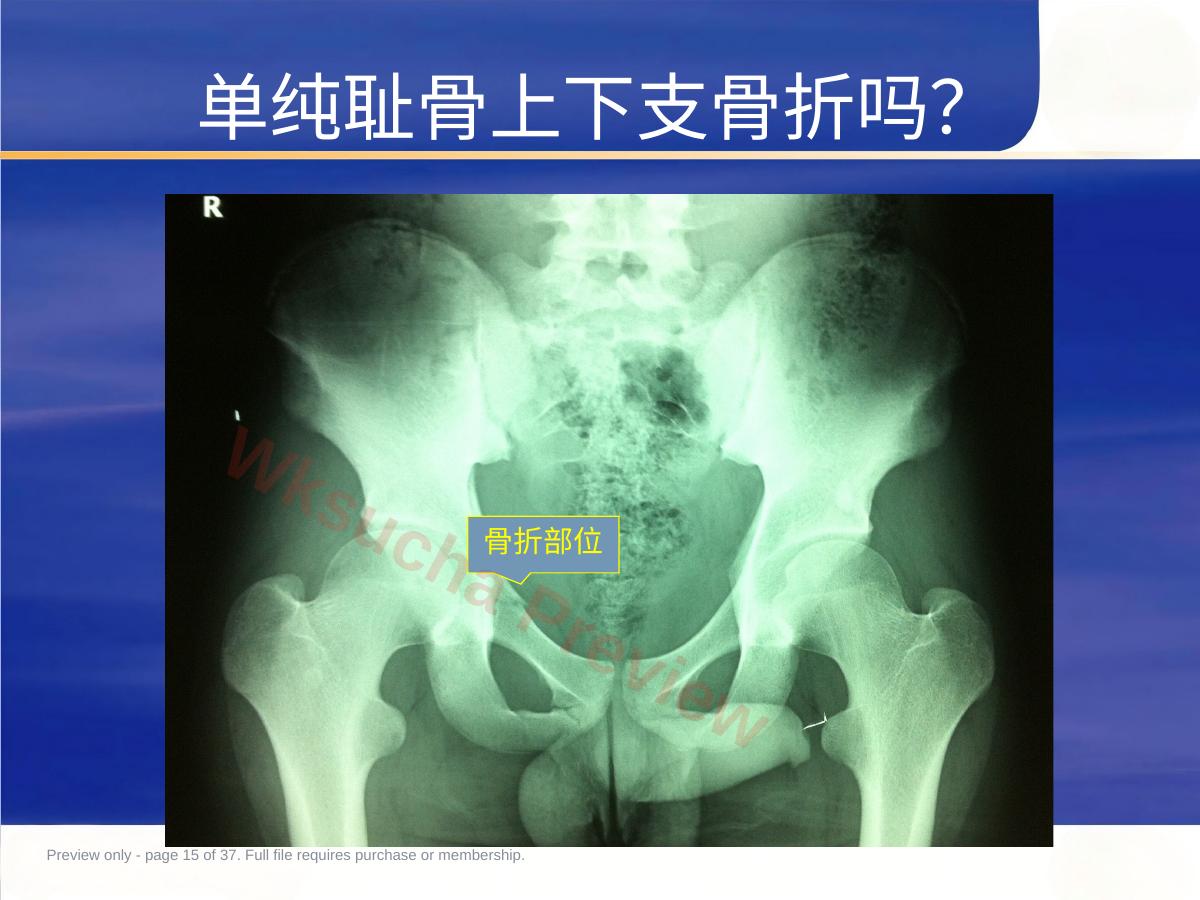 预览第 15 页