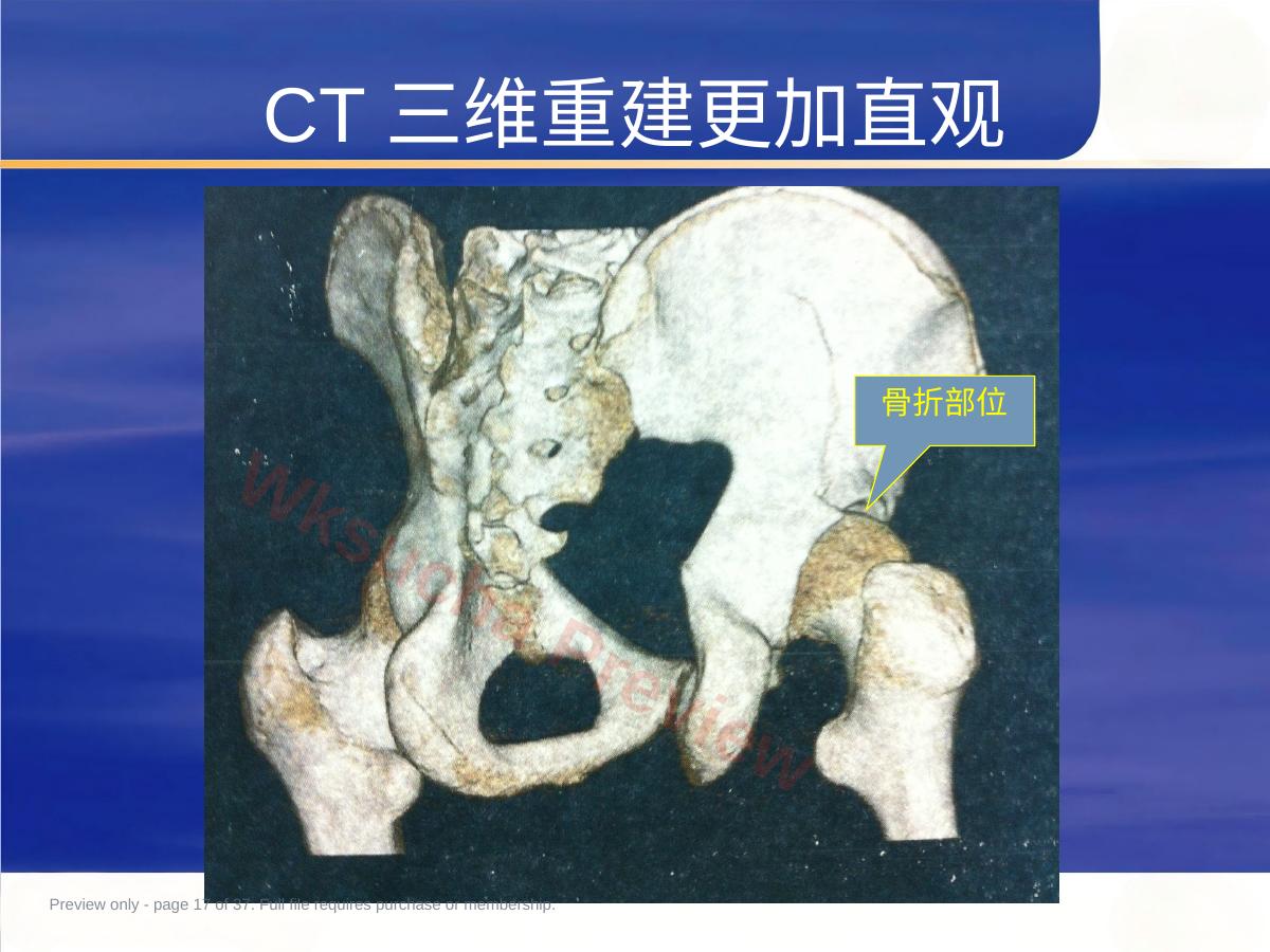 预览第 17 页
