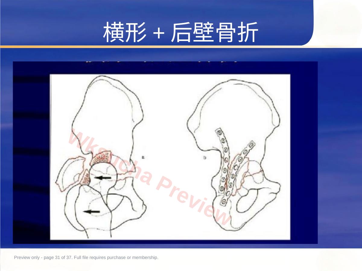 预览第 31 页