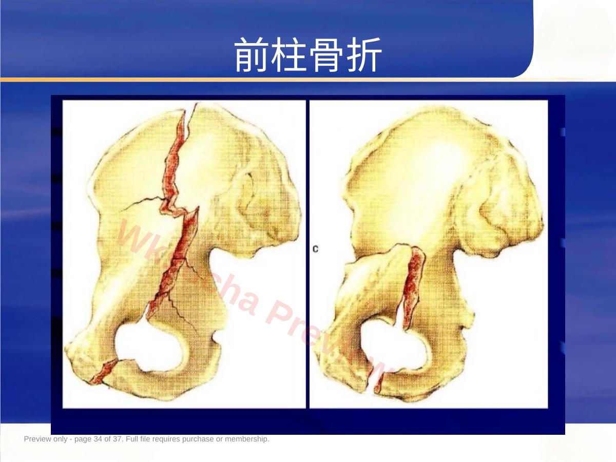 预览第 34 页
