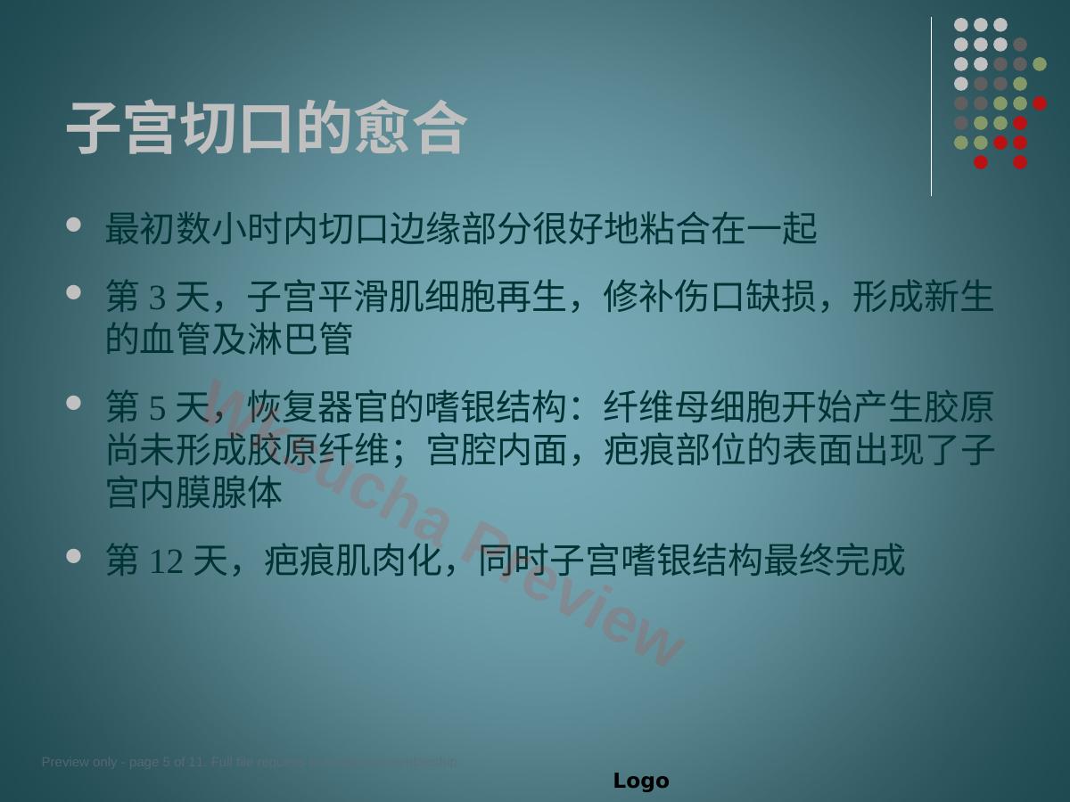 预览第 5 页