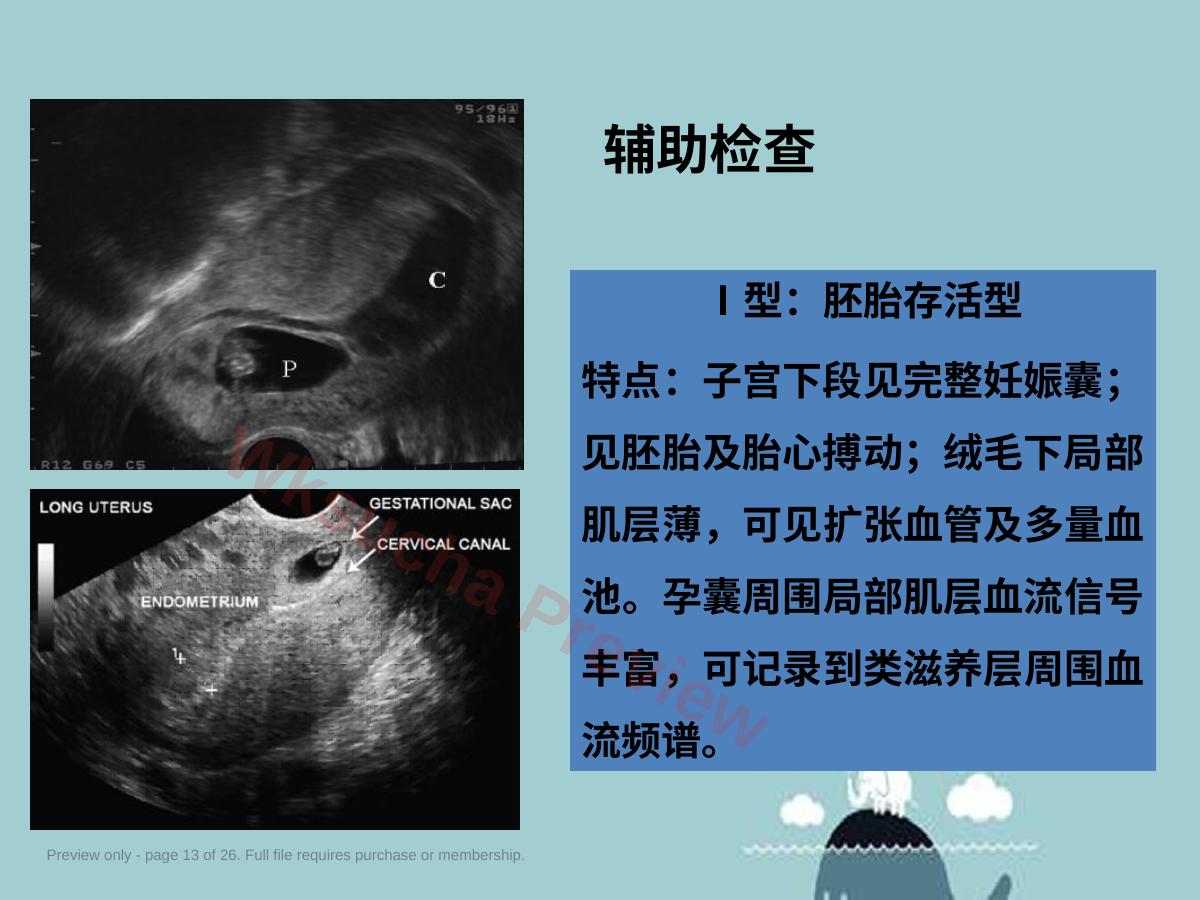 预览第 13 页