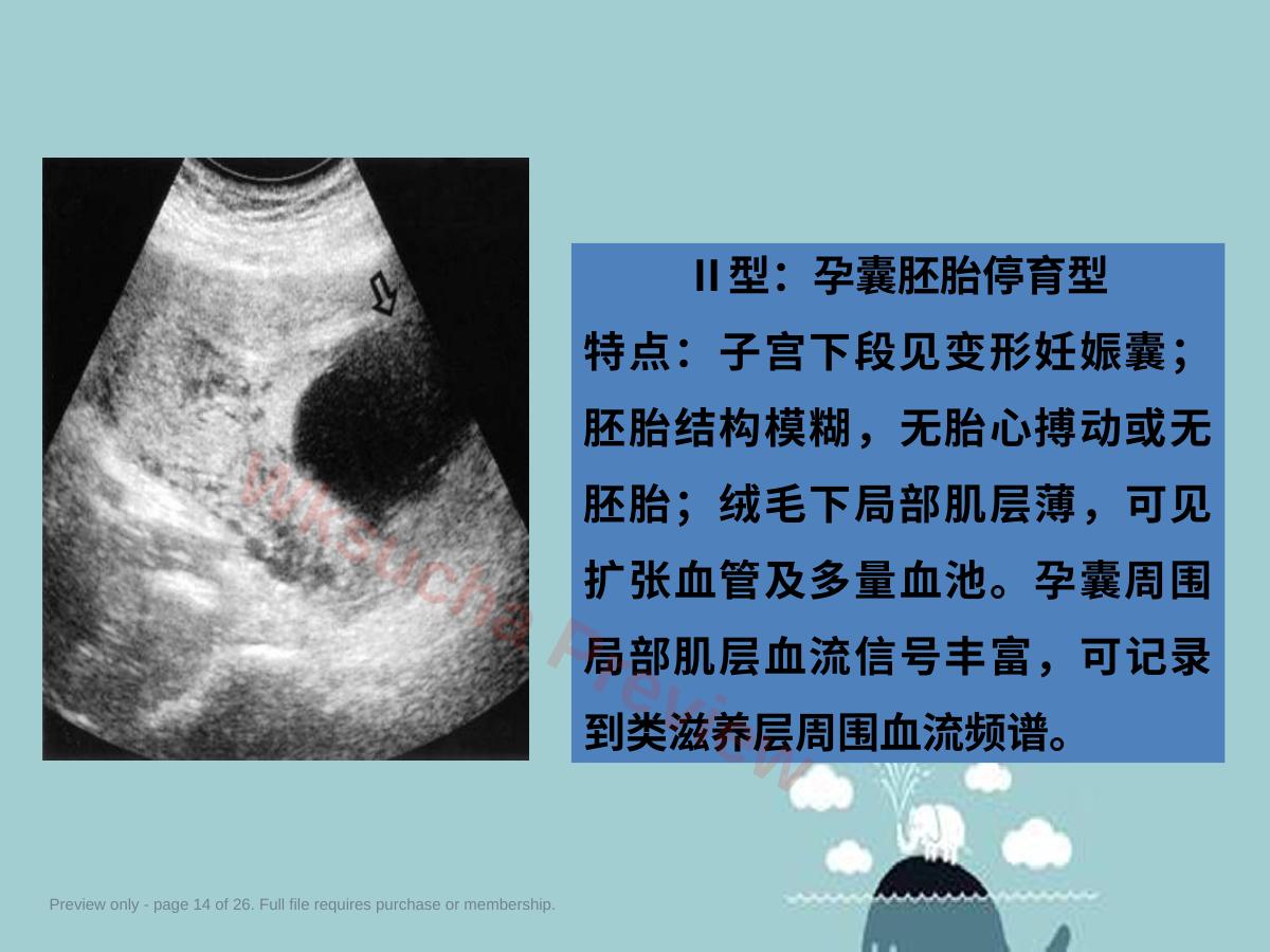 预览第 14 页
