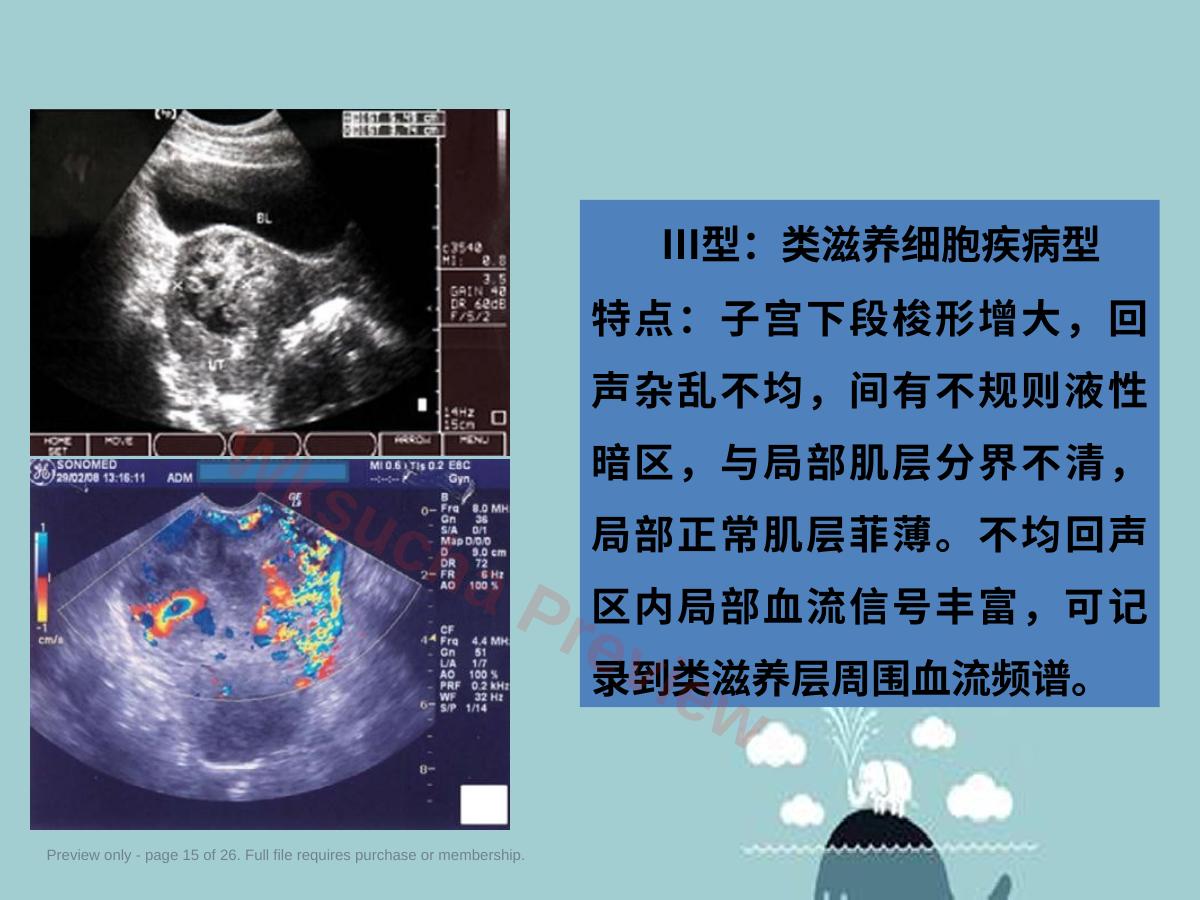 预览第 15 页
