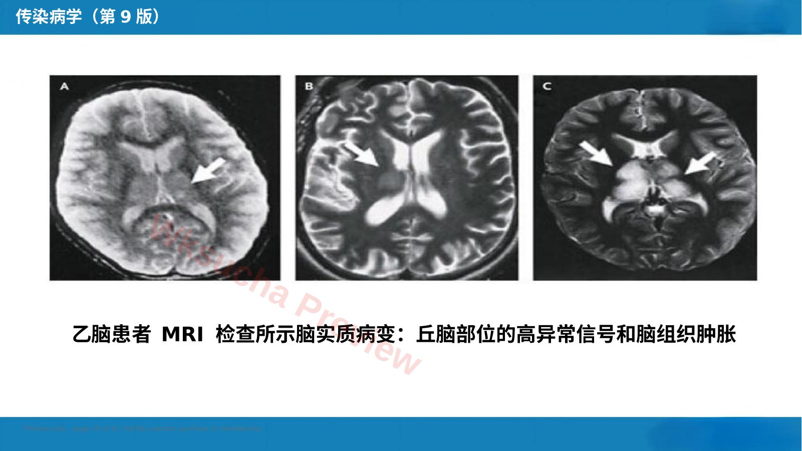 预览第 15 页