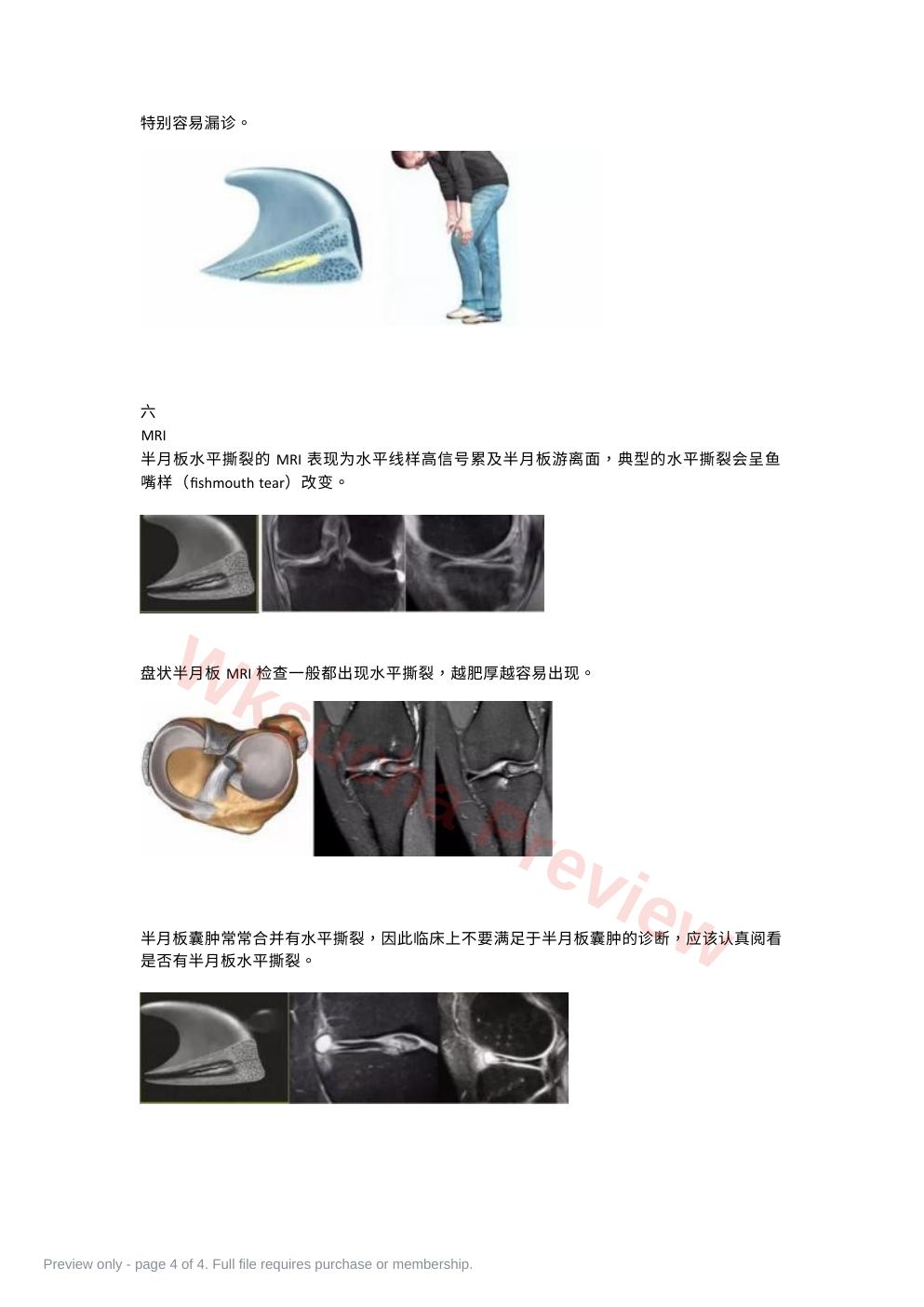 预览第 4 页