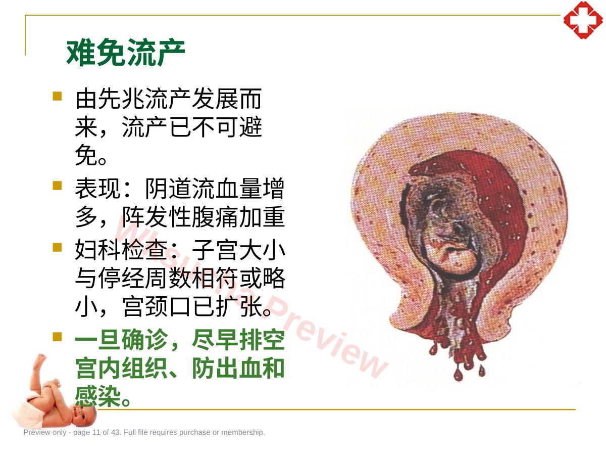 预览第 11 页