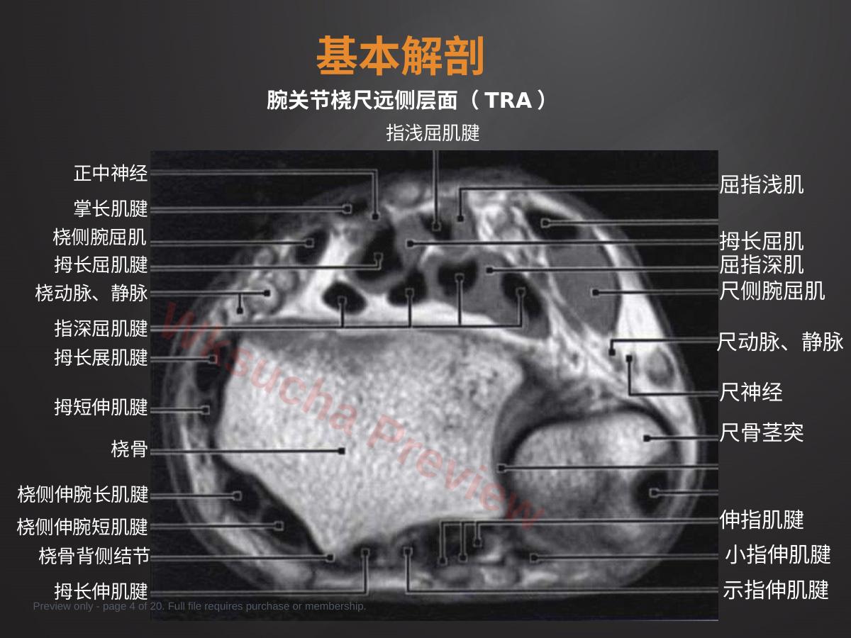 预览第 4 页