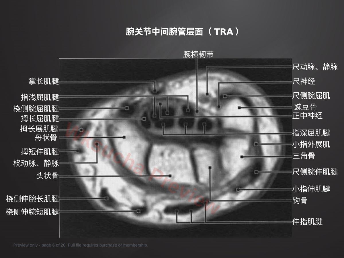 预览第 6 页