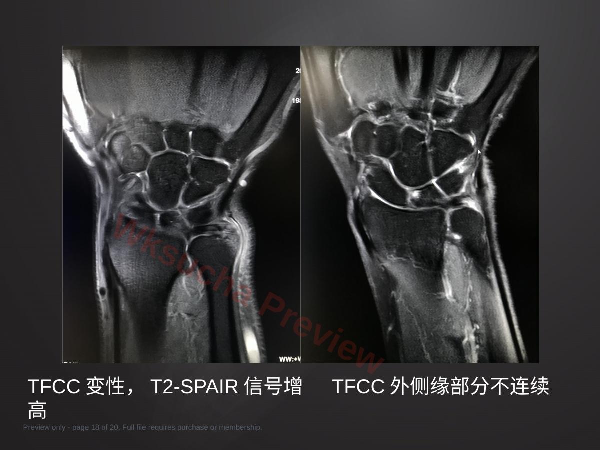 预览第 18 页