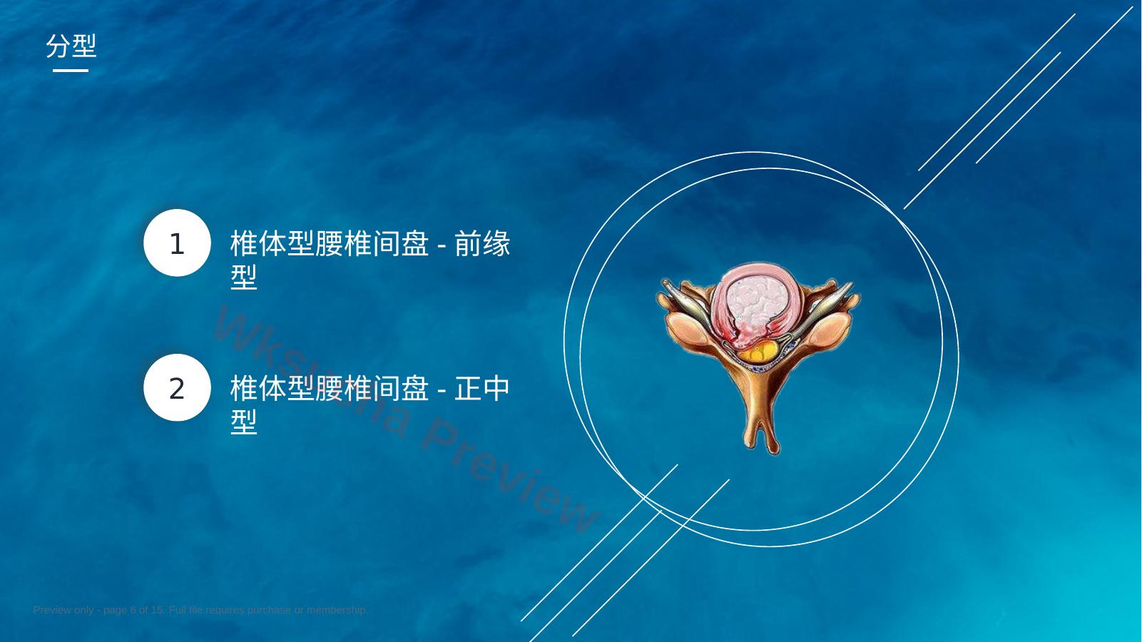 预览第 6 页