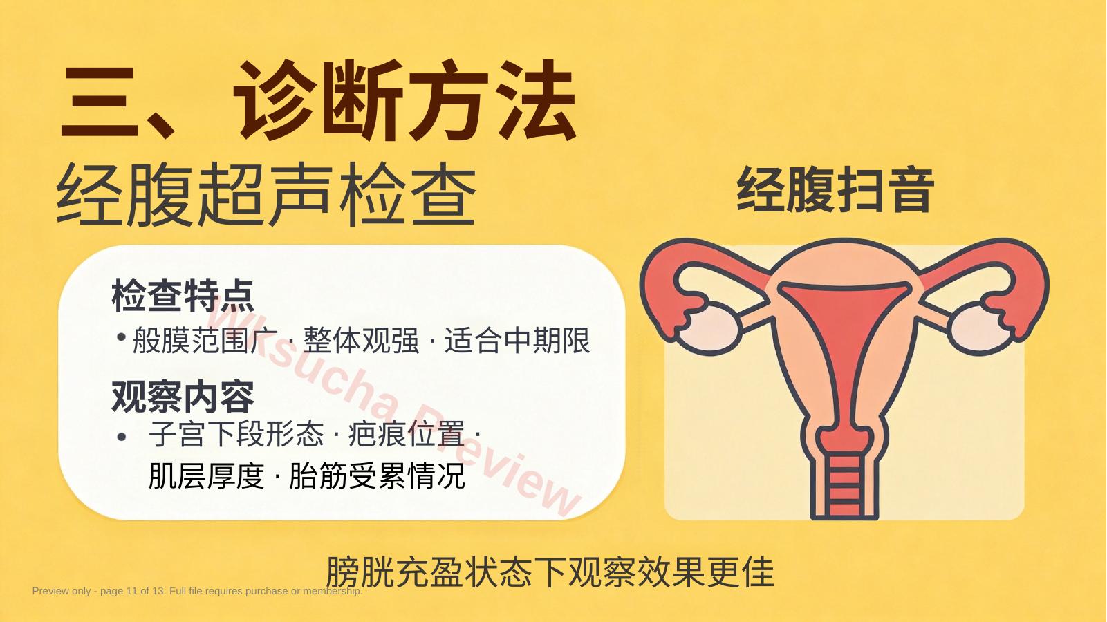 预览第 11 页