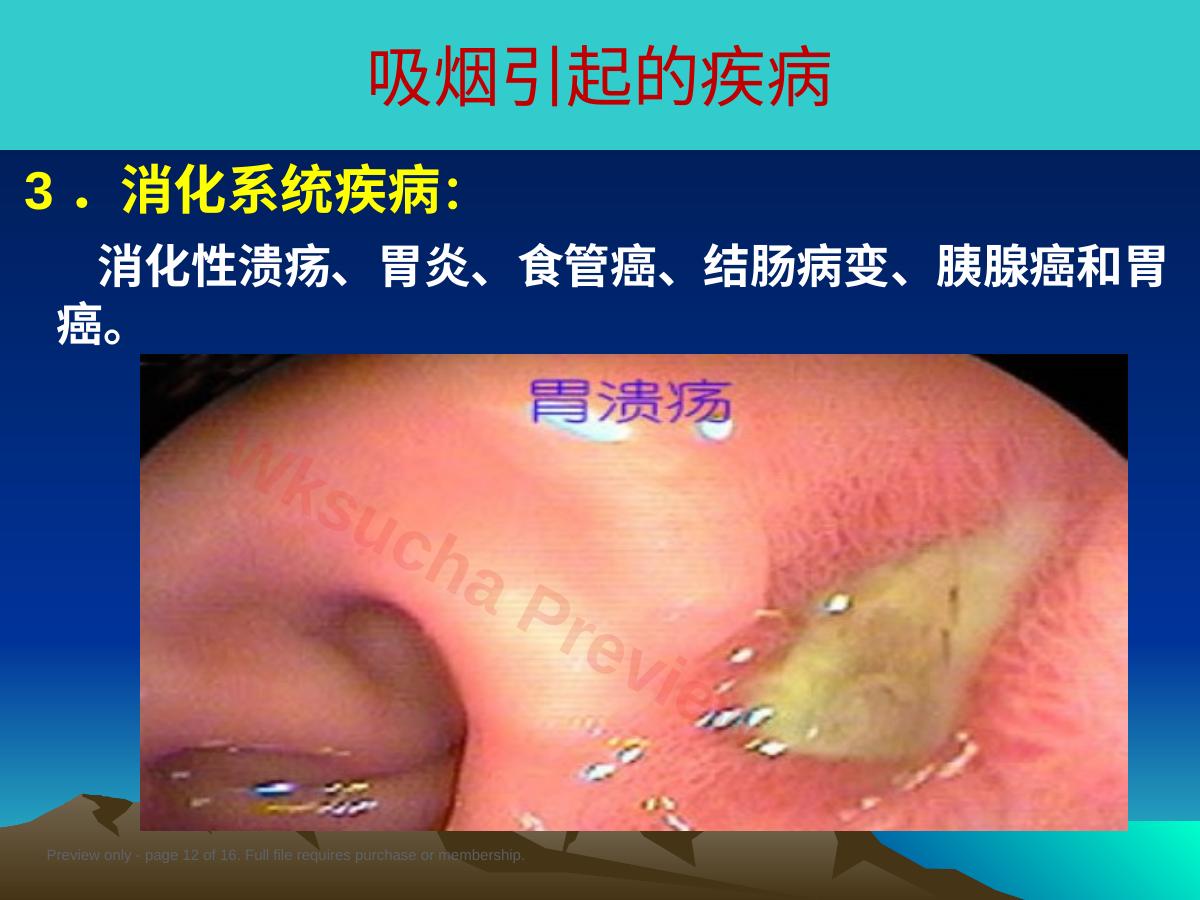 预览第 12 页