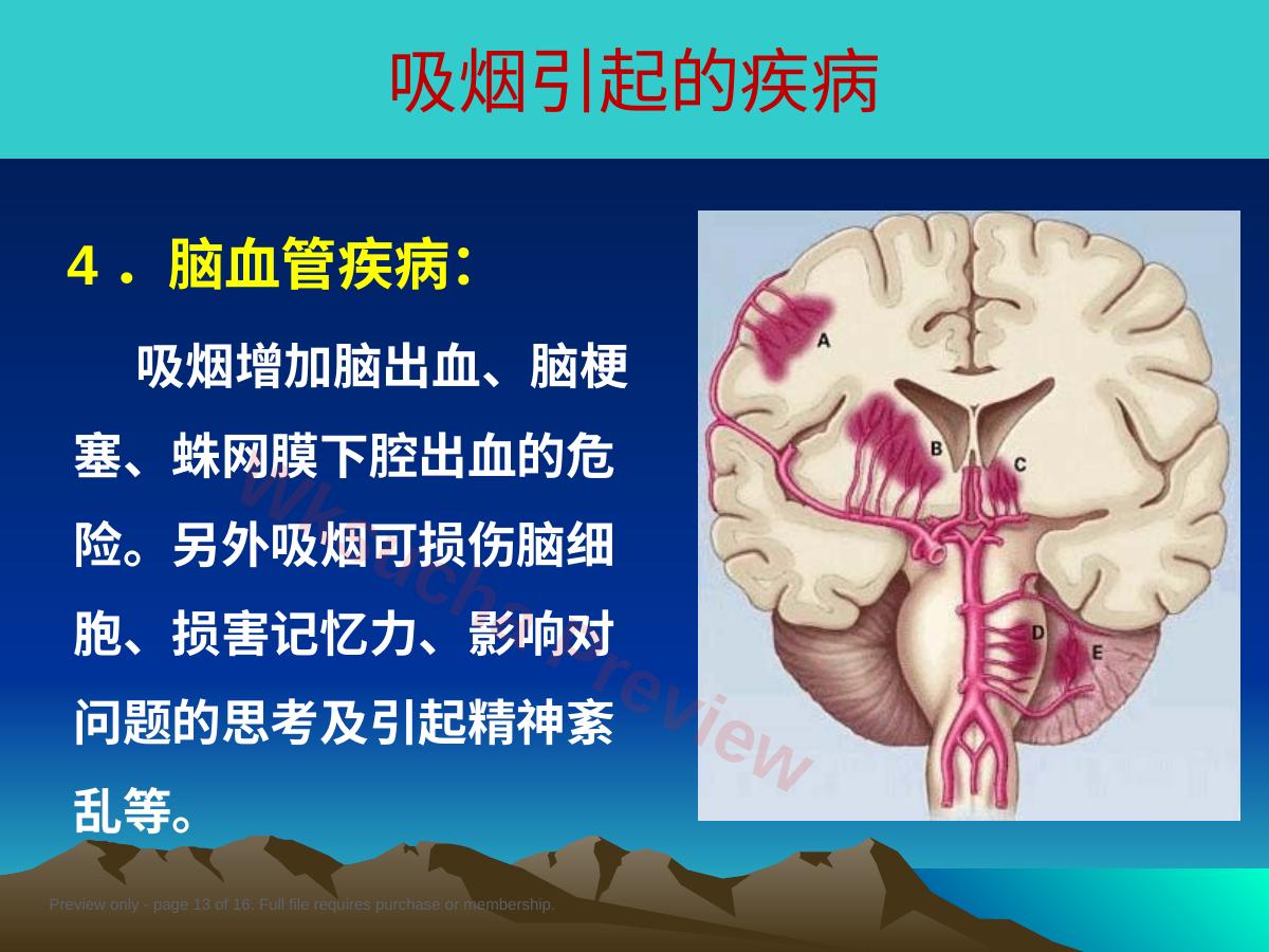 预览第 13 页