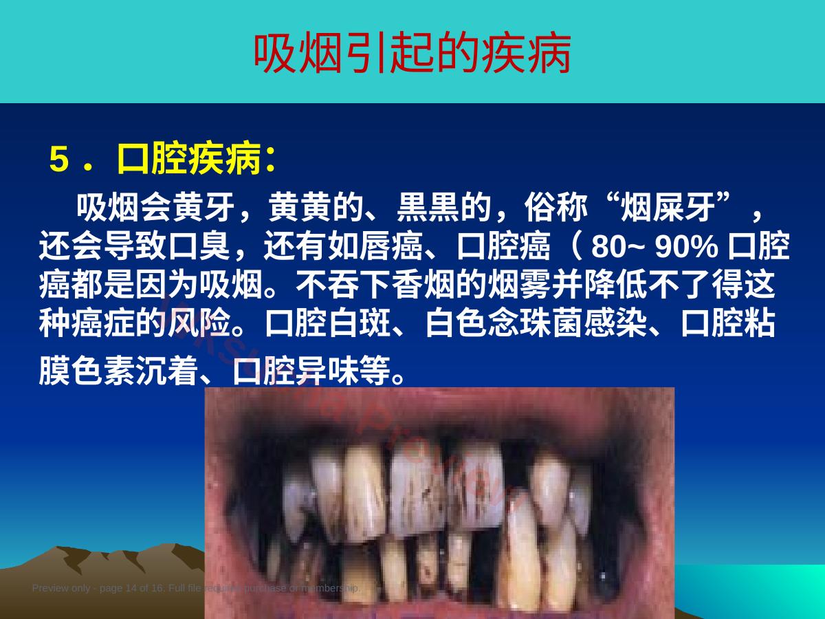 预览第 14 页