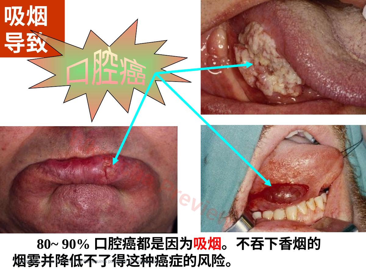 预览第 15 页