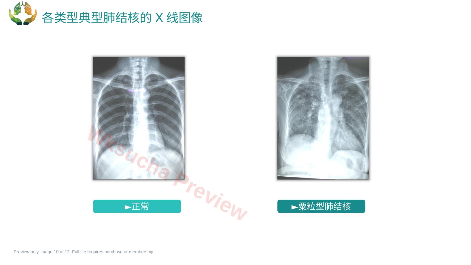 预览第 10 页