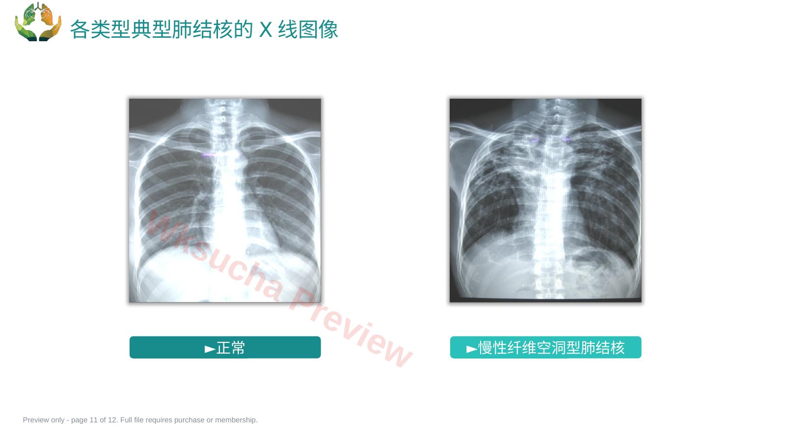 预览第 11 页
