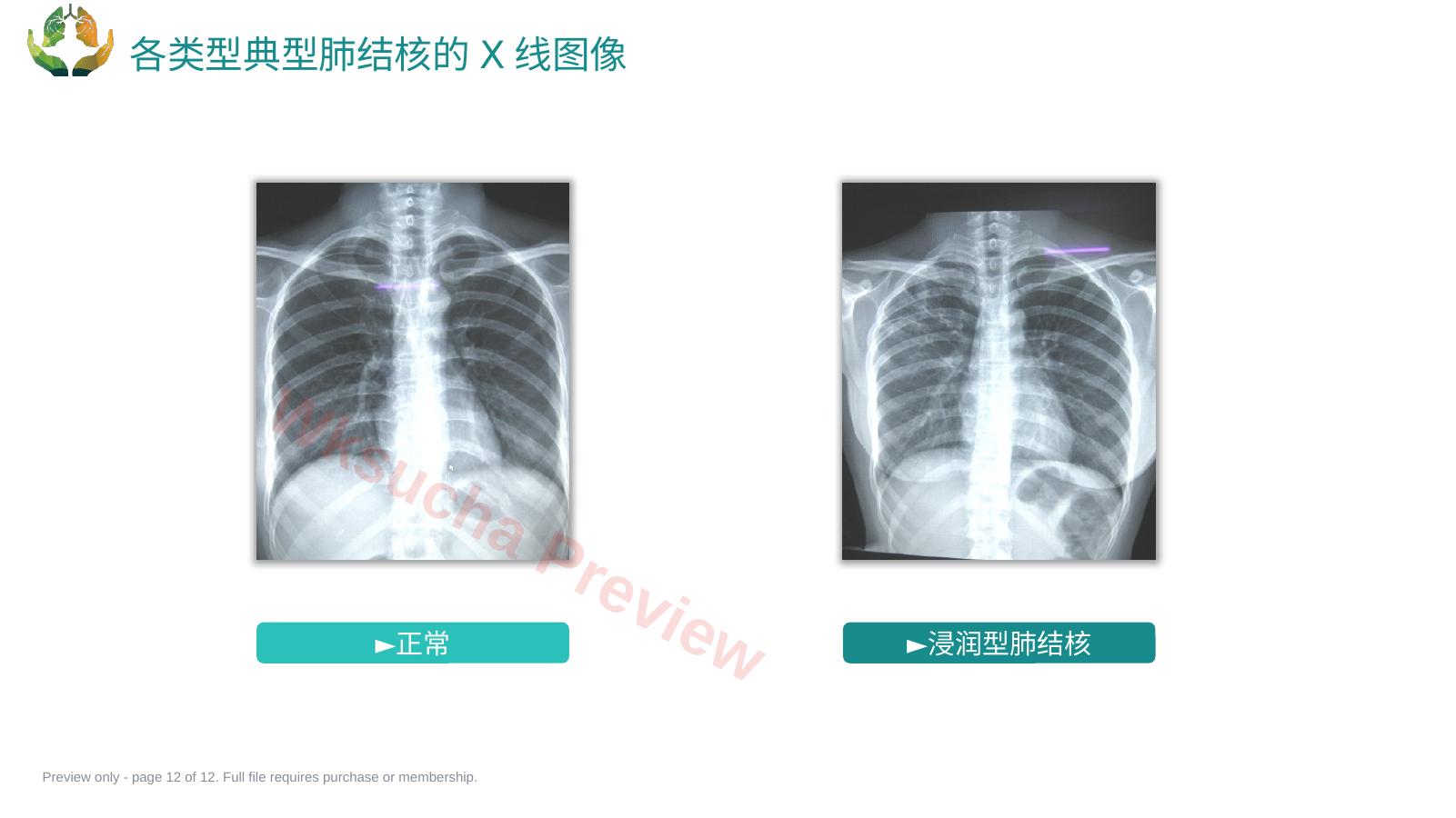 预览第 12 页