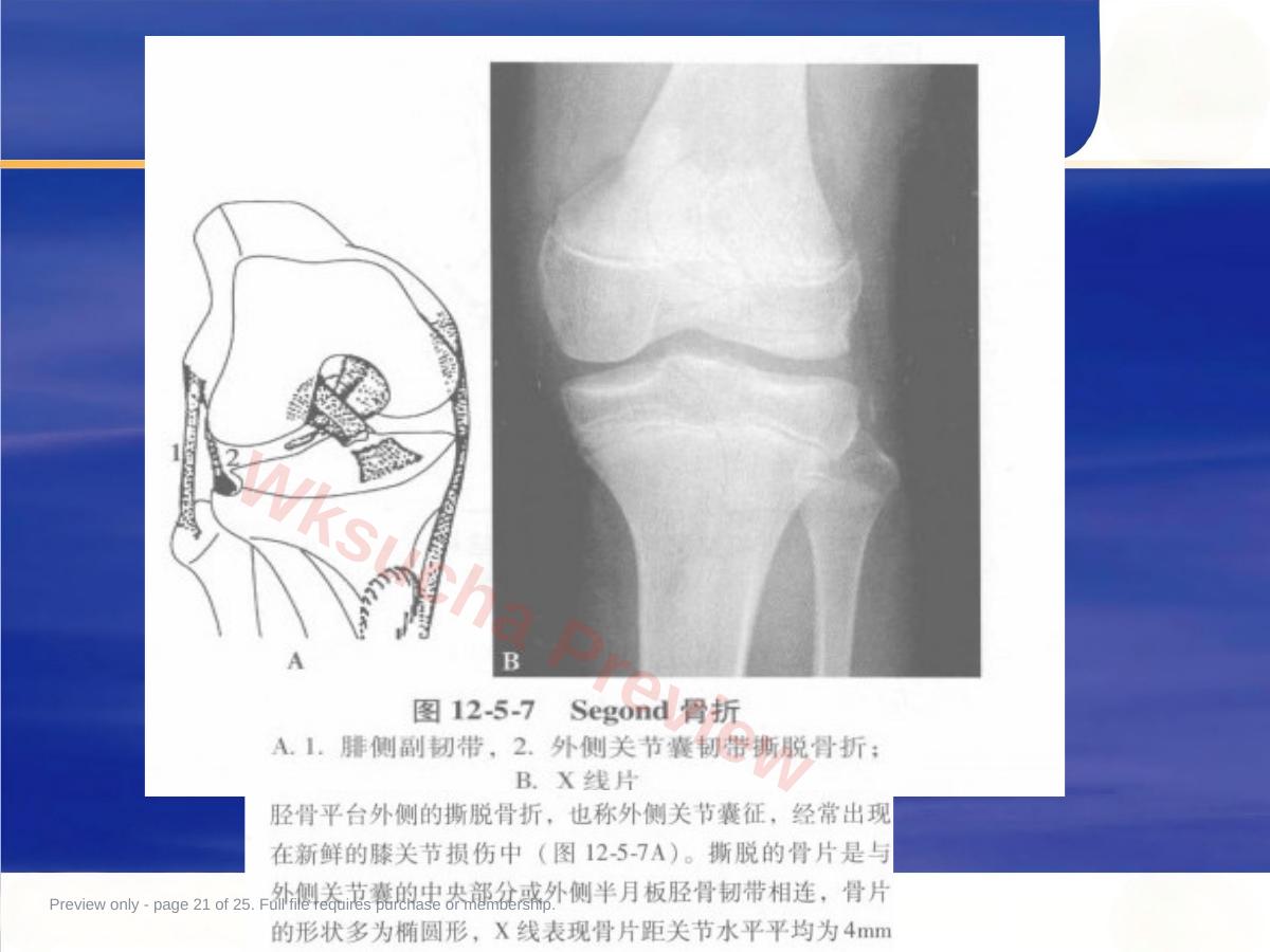 预览第 21 页