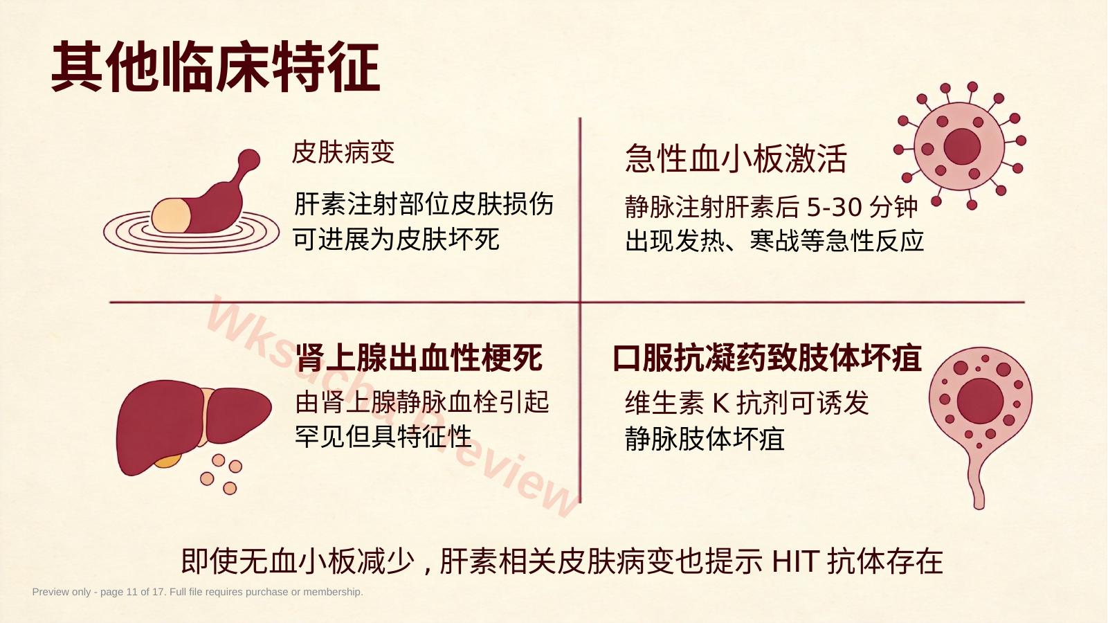 预览第 11 页
