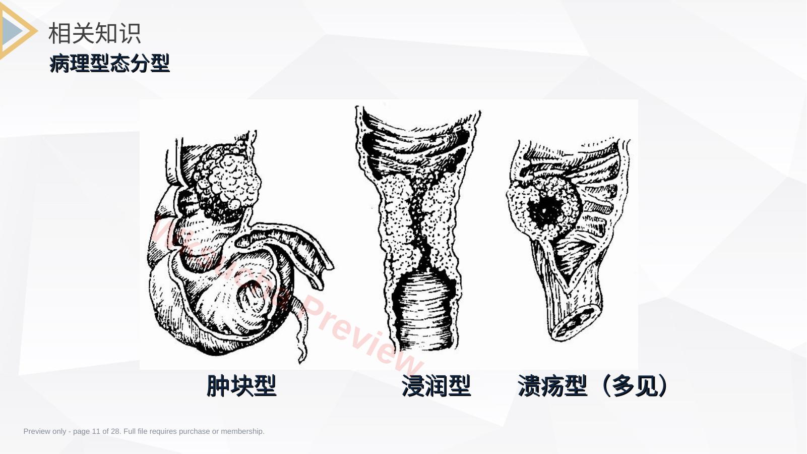 预览第 11 页