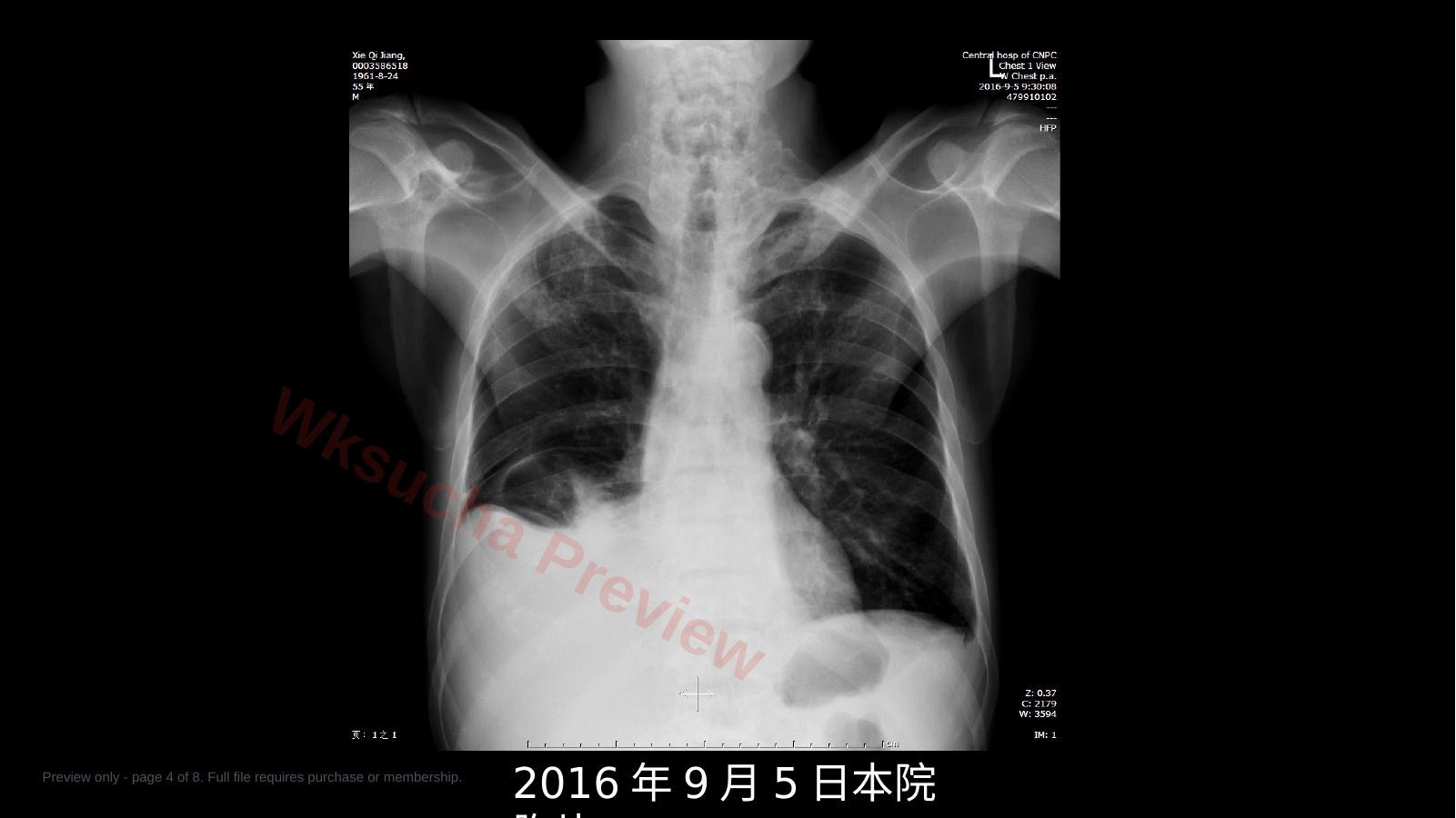 预览第 4 页