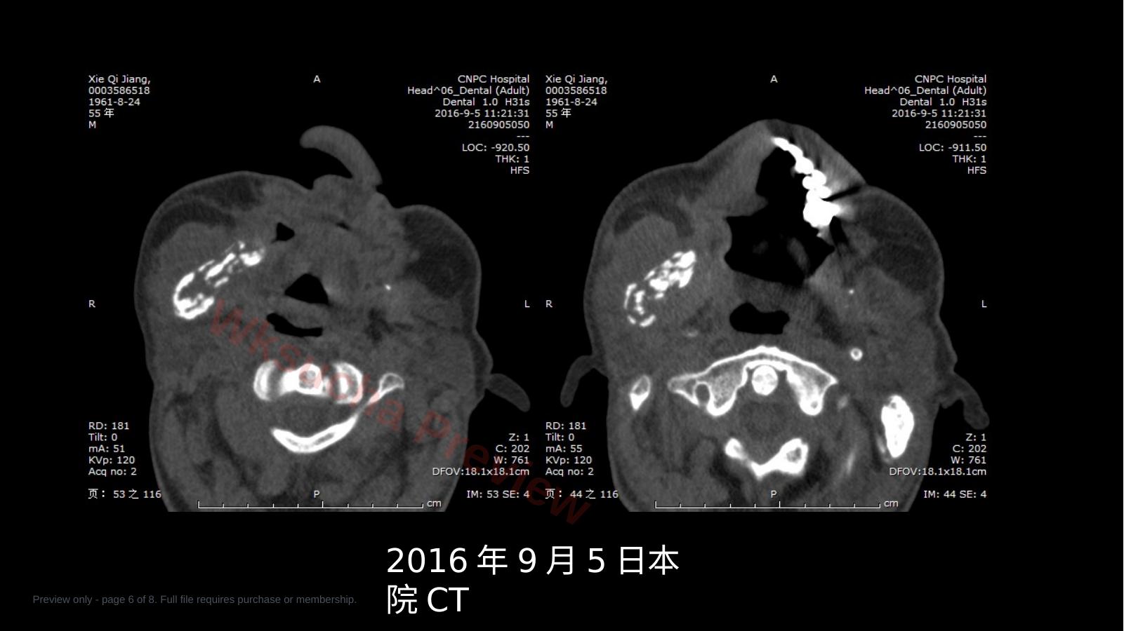 预览第 6 页