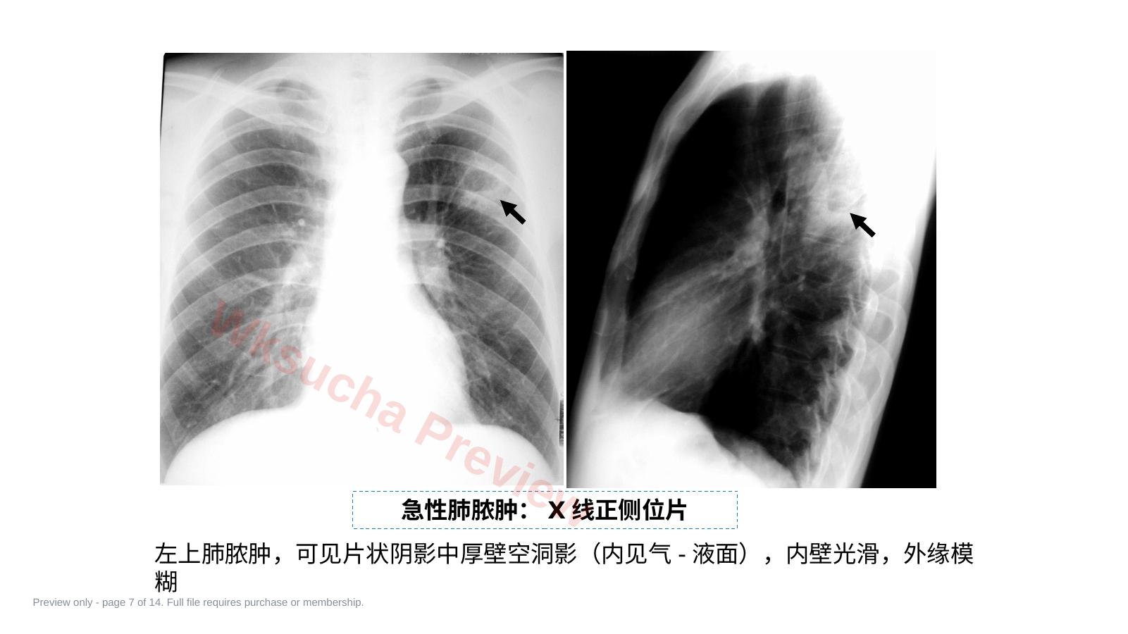 预览第 7 页